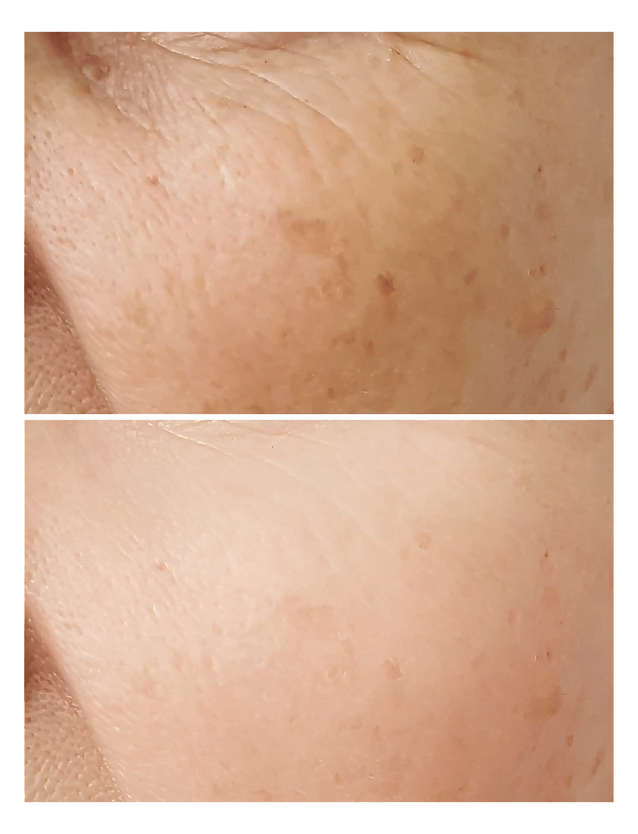 âme pure - C-Brigther Days - Vitamin C Fruit Extracts Brightening Toner - niisutavad toonikud - orange - 5
