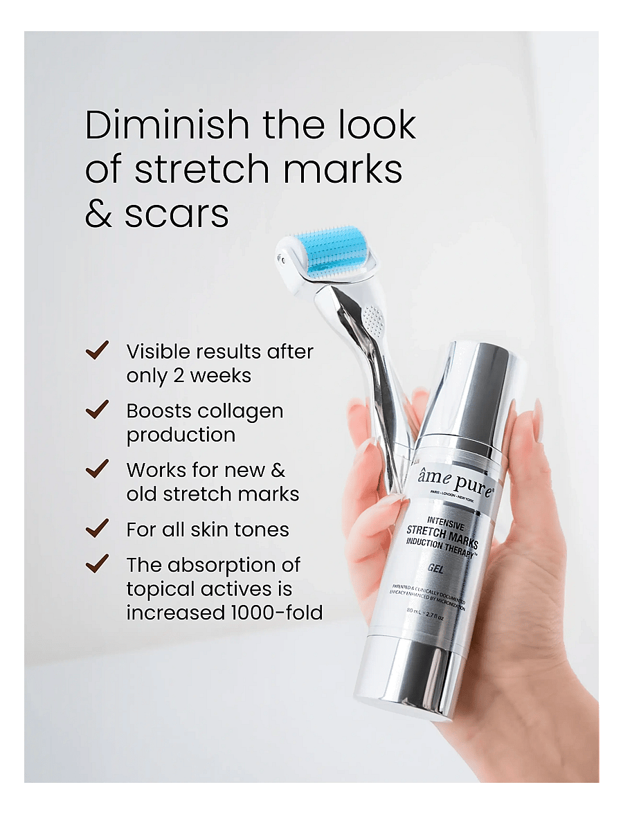 âme pure - Body Basic | Stretch Marks - Derma Roller Kit for Body - silver-blue - 2
