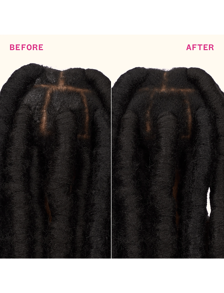 AMIKA - Reset - Pink Charcoal Scalp Cleansing Oil - scalp treatment - clear - 4