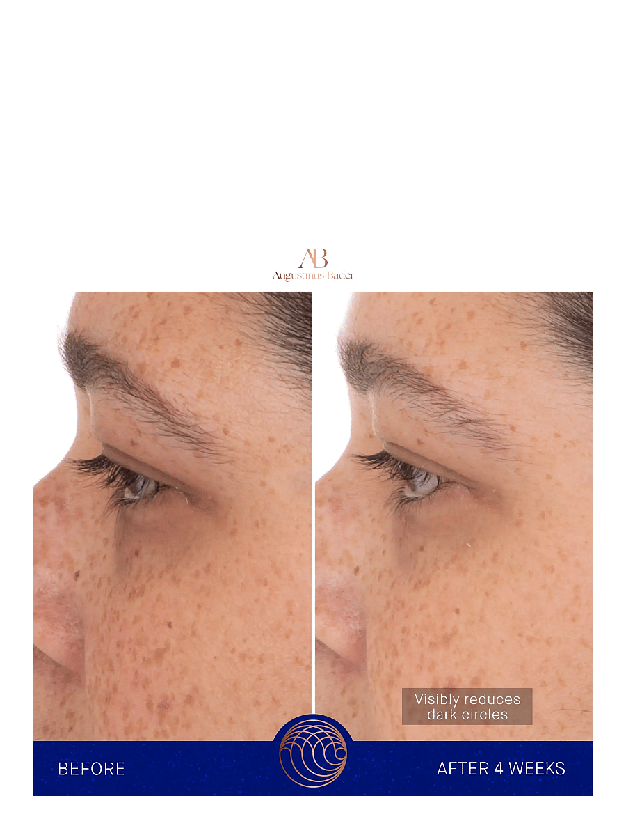 Augustinus Bader - AUG EYE PATCHES 1x3G - augnleppar - clear - 4
