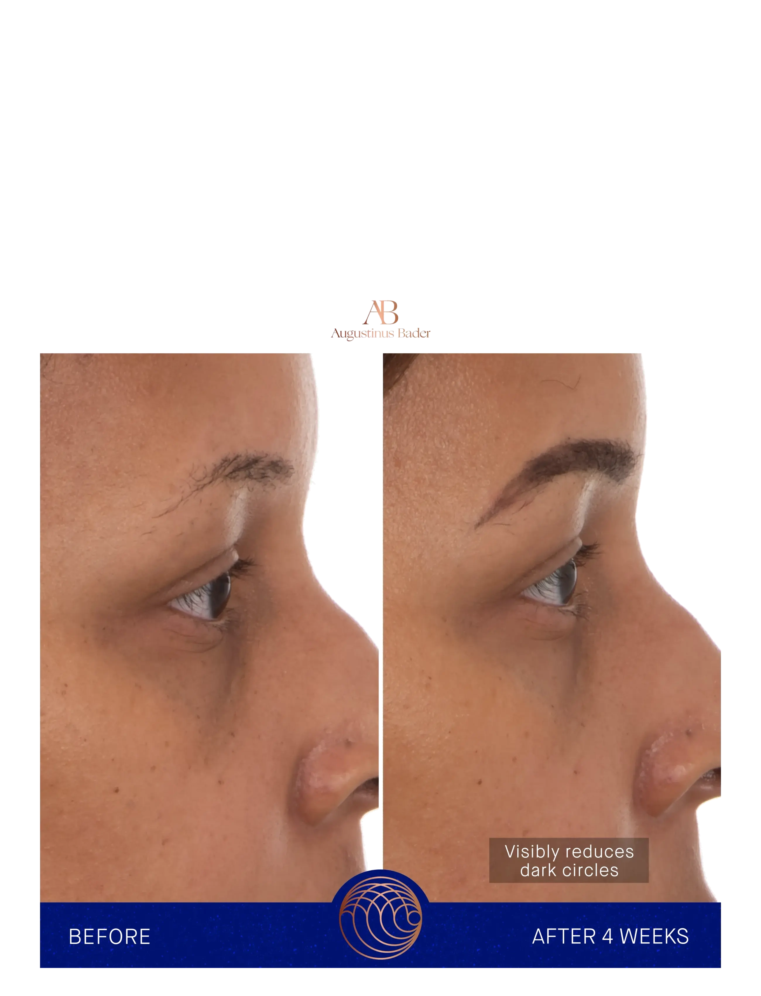 Augustinus Bader Aug Eye Patches 1X3G ögonvård dam – bild 6