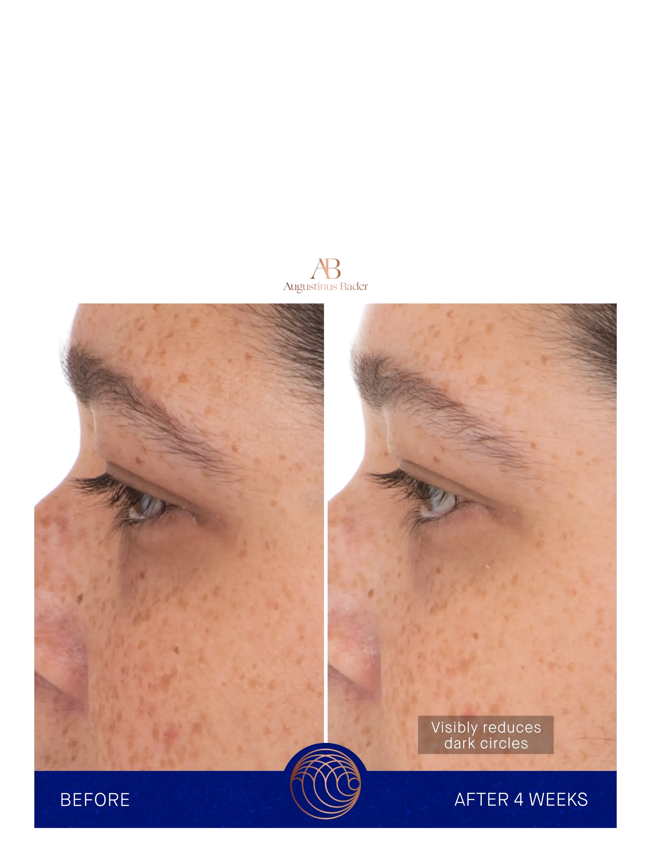 Augustinus Bader - AUG  EYE PATCHES 6x3G - Øjenmasker - clear - 5
