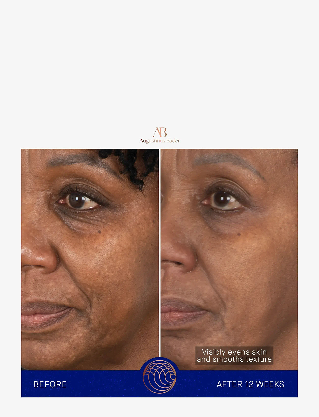 Augustinus Bader - AUG FACE CREAM MASK 50ML - ansigspleje - clear - 4