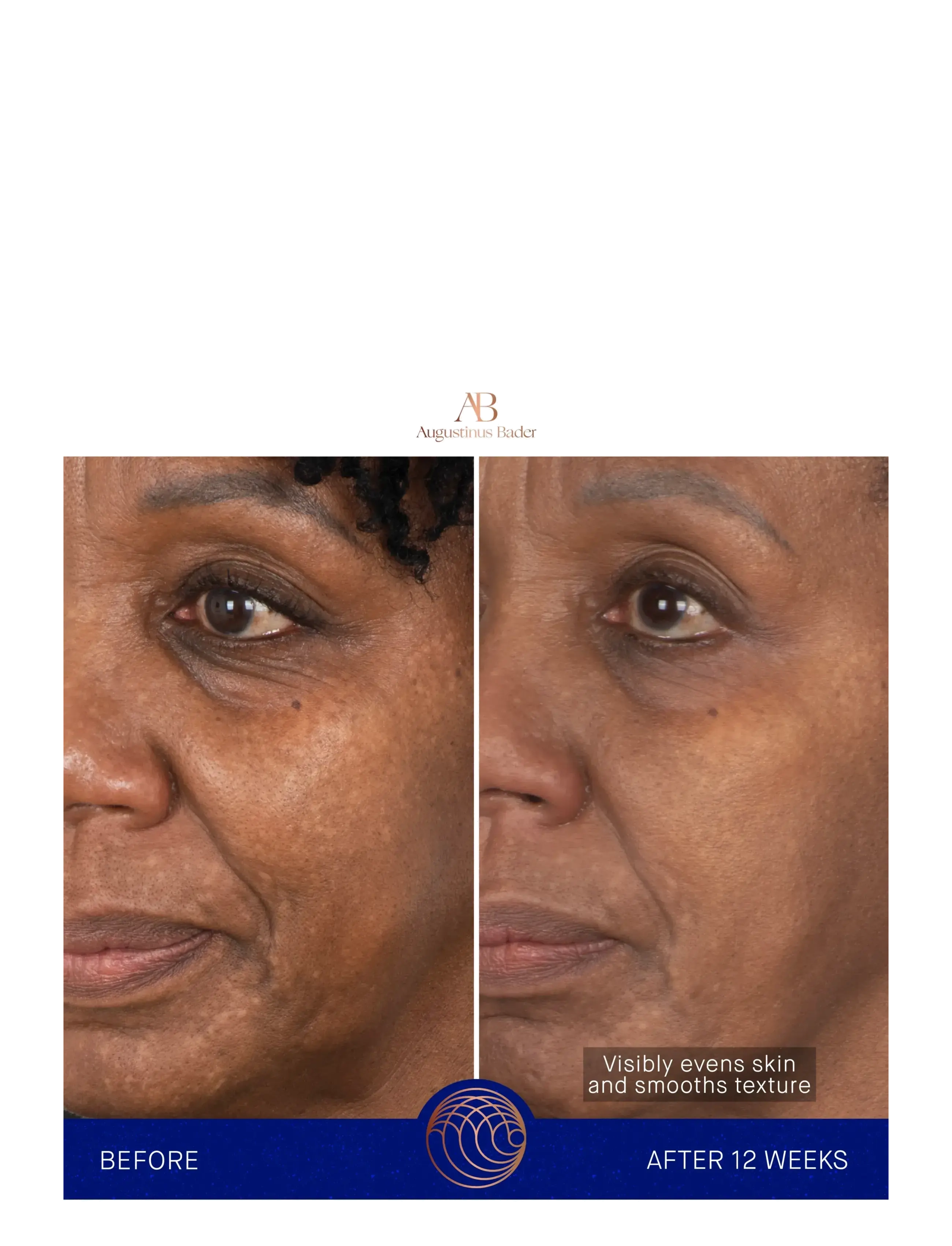 Augustinus Bader - AUG FACE CREAM MASK 50ML - ansigspleje - clear - 4
