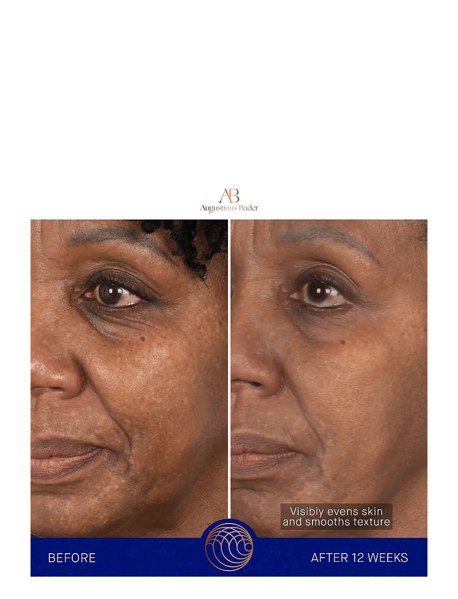 Augustinus Bader - AUG FACE CREAM MASK 50ML - Återfuktande masker - clear - 4