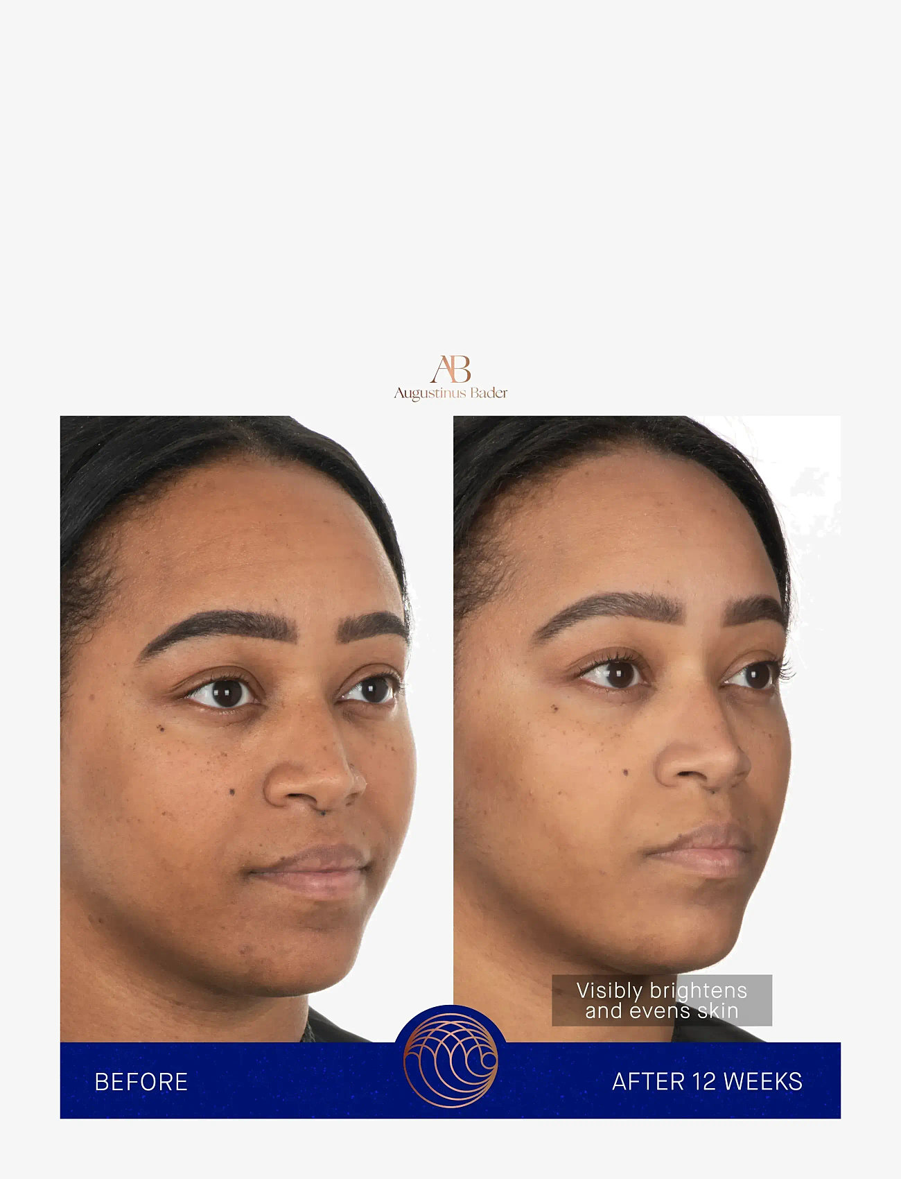 Augustinus Bader - AUG FACE CREAM MASK 50ML - ansigspleje - clear - 5