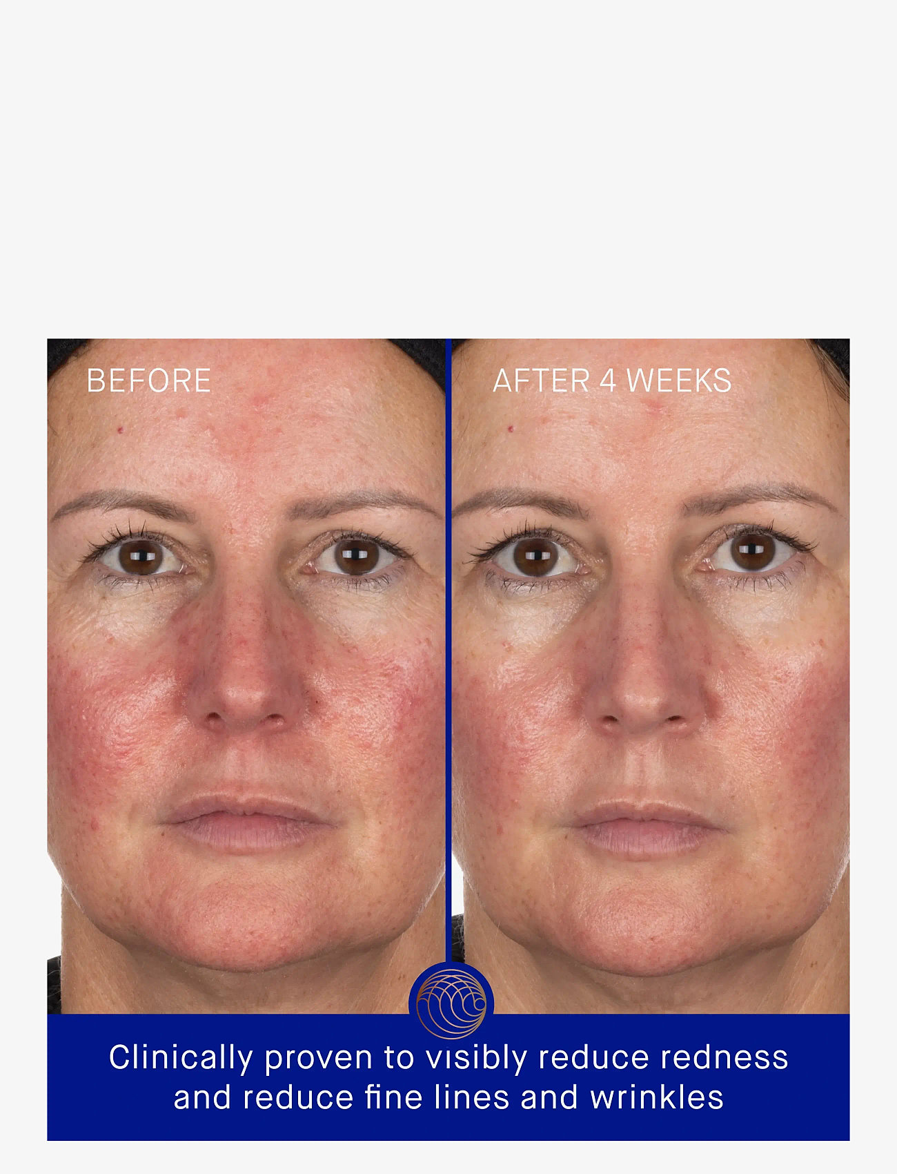 Augustinus Bader - AUG THE HYDROGEL FACEMASK 6PCK - sheet masks - clear - 2