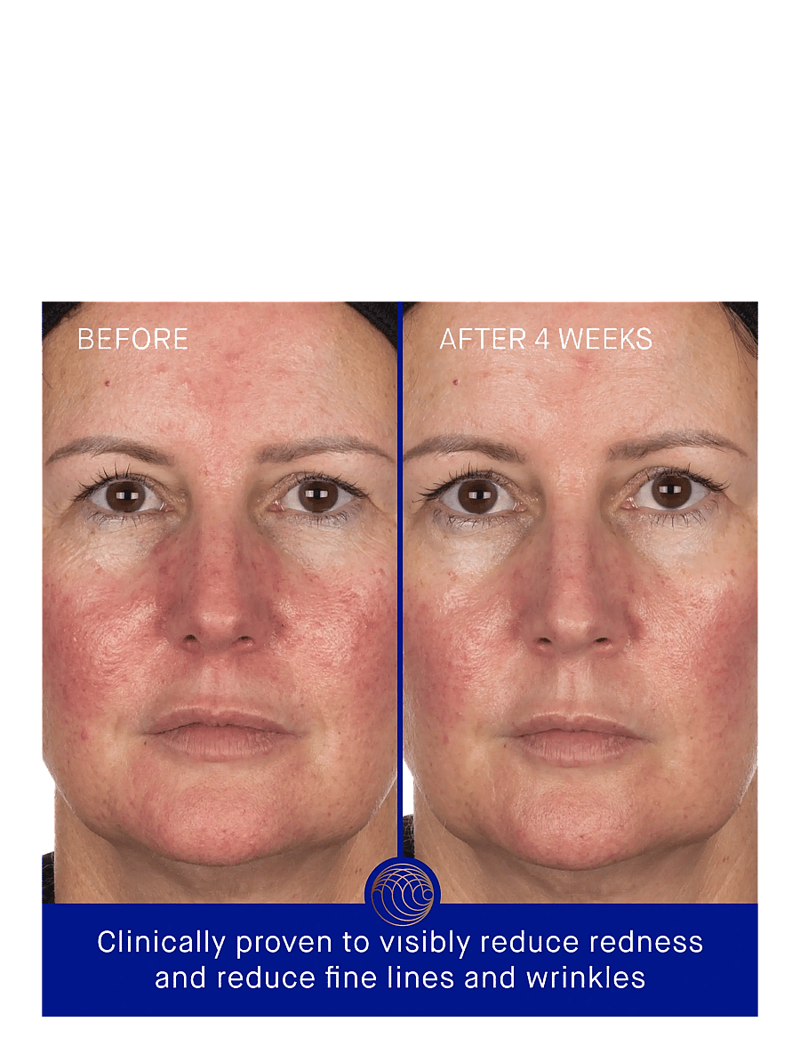 Augustinus Bader - AUG THE HYDROGEL FACEMASK 6PCK - sheet masks - clear - 2
