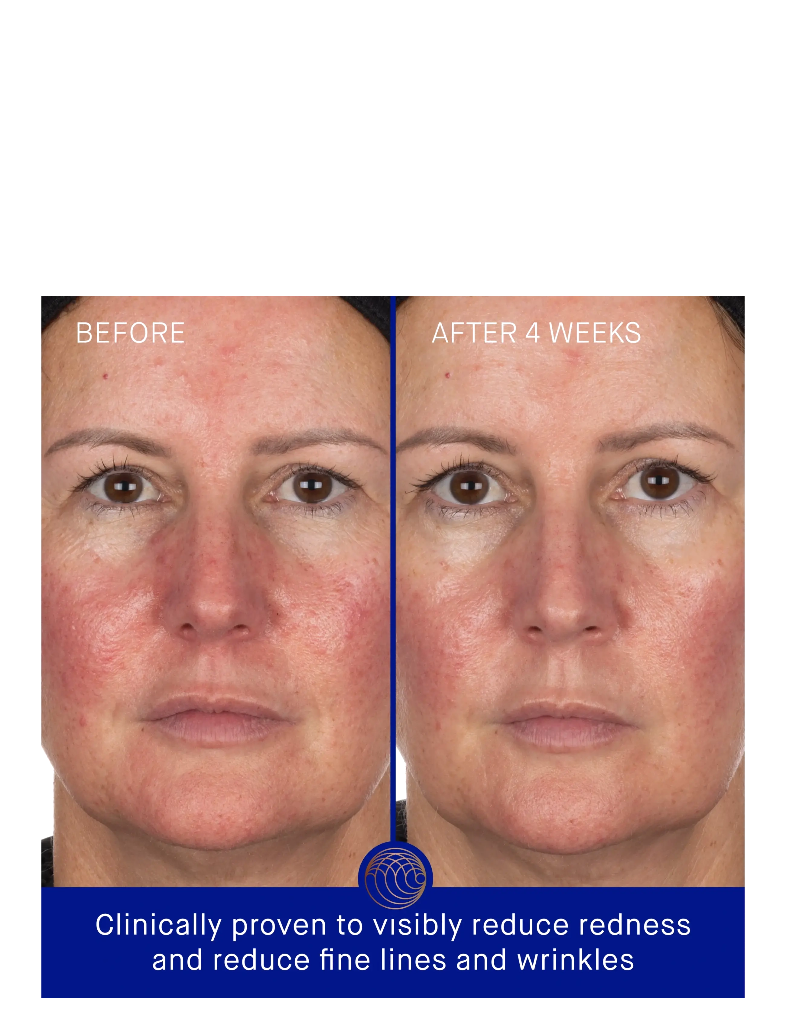 Augustinus Bader - AUG THE HYDROGEL FACEMASK SING - sheet masks - clear - 2