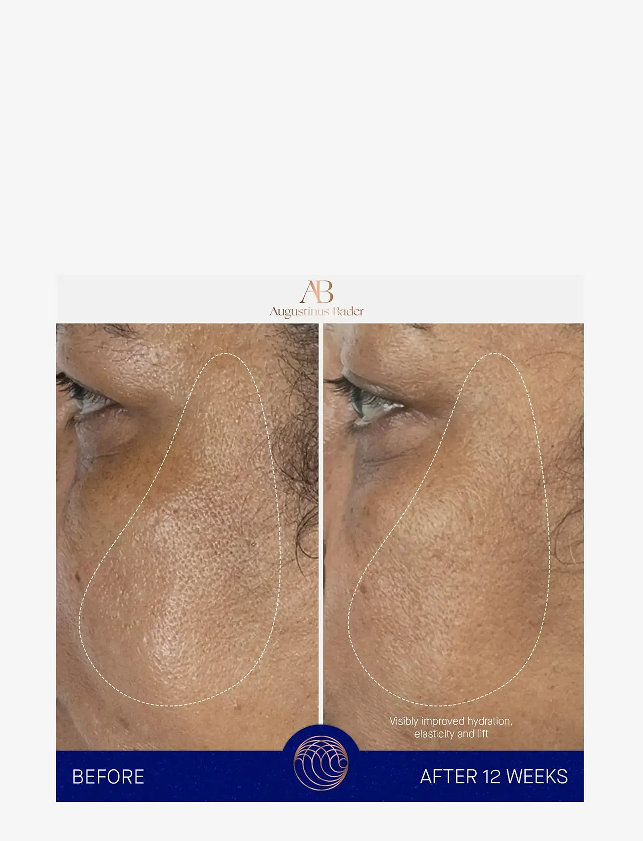 Augustinus Bader - AUG THE SERUM FULL SET - serum - clear - 5