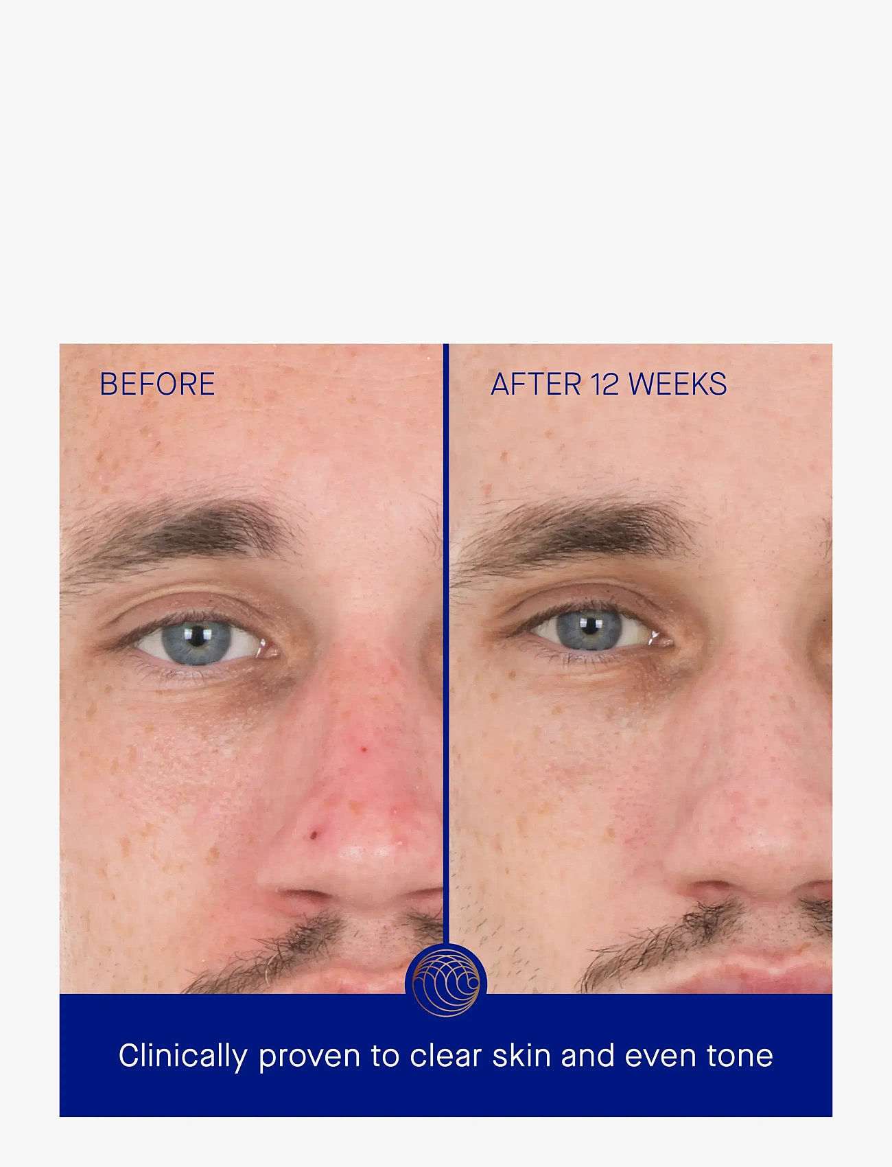 Augustinus Bader - AUG RETINOL SERUM 50ML - kasvot - clear - 4