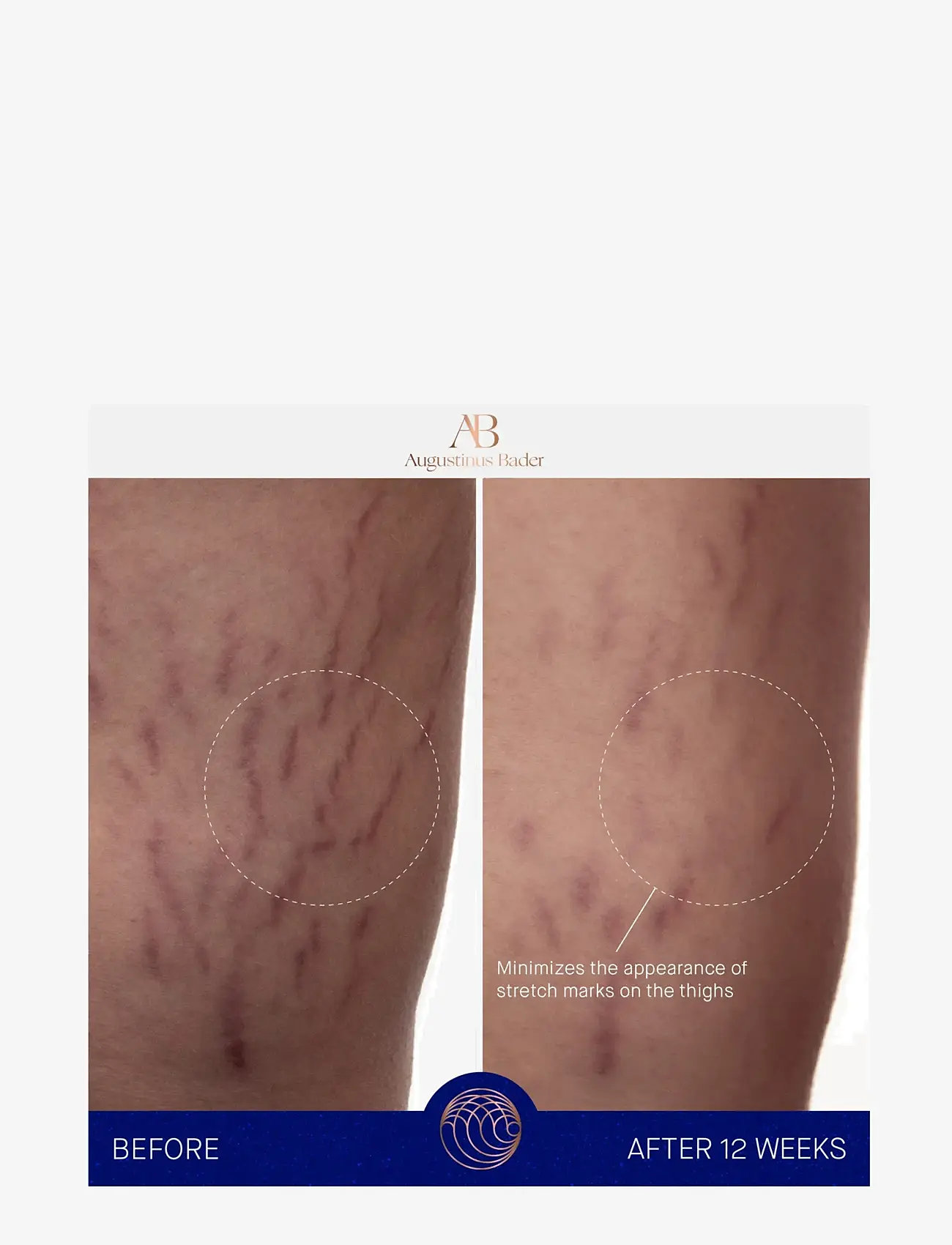 Augustinus Bader - AUG BODY CREAM 100ML - lotion & cream - clear - 5