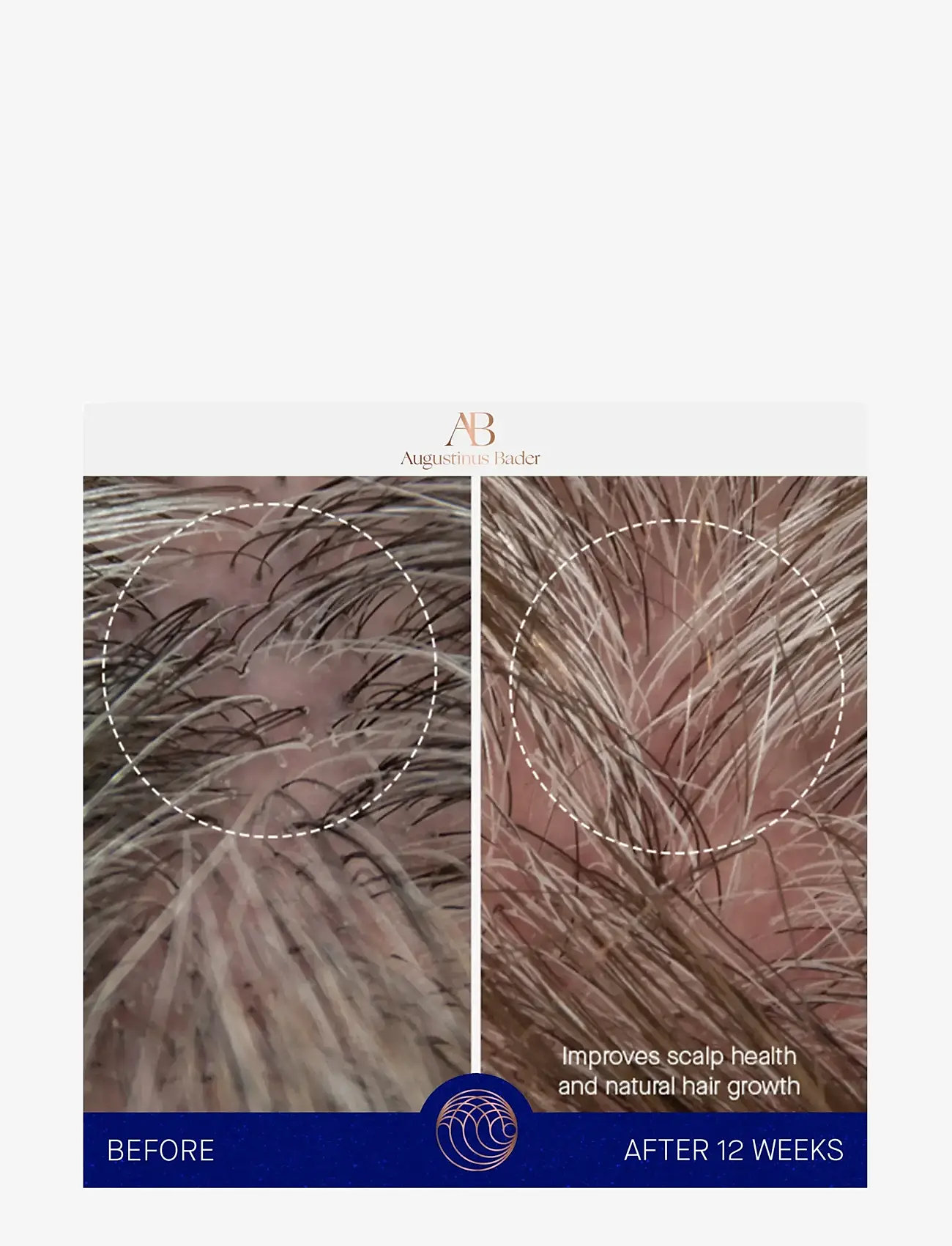 Augustinus Bader - AUG CONDITIONER 150ML - hårpleje - clear - 5