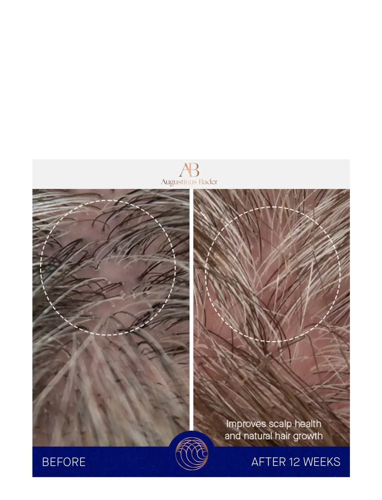 Augustinus Bader - AUG CONDITIONER 150ML - hårpleje - clear - 5