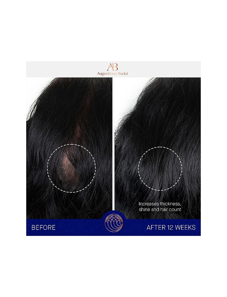 Augustinus Bader - AUG SCALP TREATMENT 30ML - hår - clear - 0