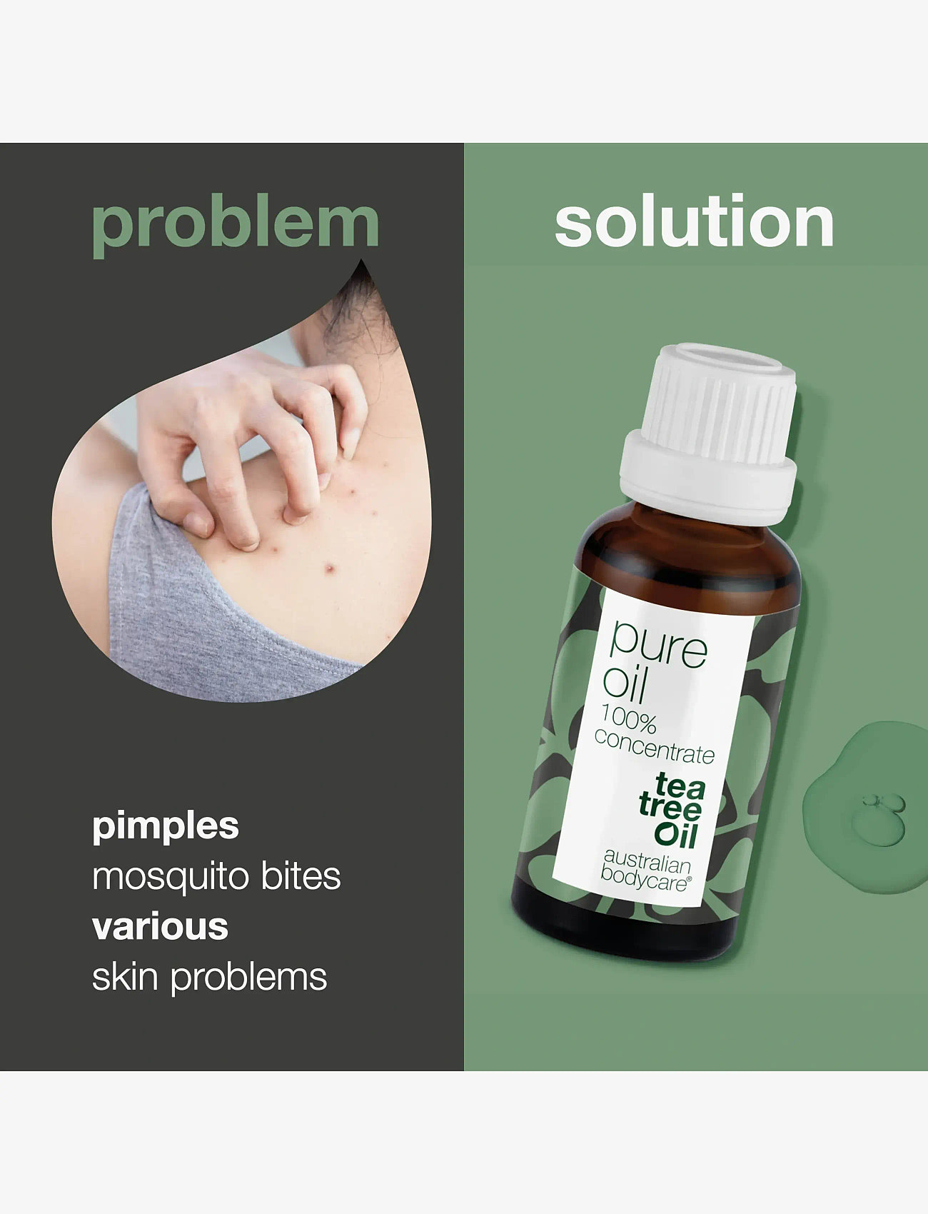 Australian Bodycare - Pure Tea Tree Oil 30 ml - resestorlekar & kits - no color - 2