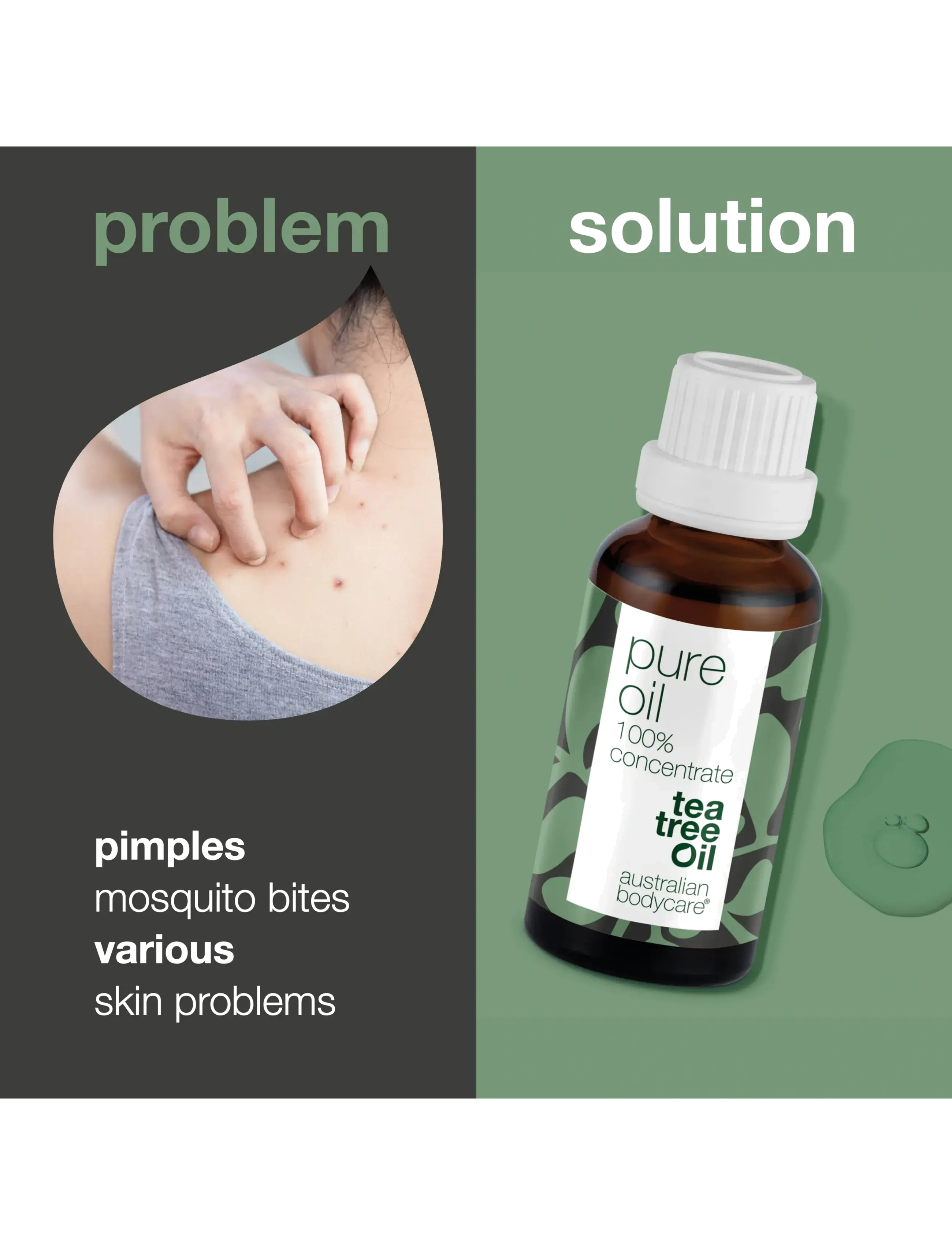 Australian Bodycare - Pure Tea Tree Oil 30 ml - rejsestørrelser & kits  - no color - 2
