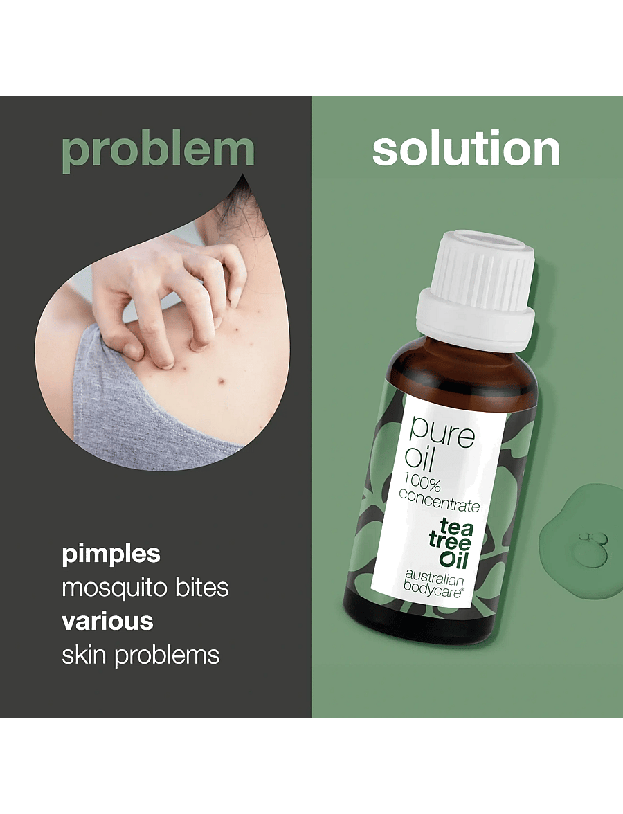 Australian Bodycare - Pure Tea Tree Oil 30 ml - olíur - no color - 2