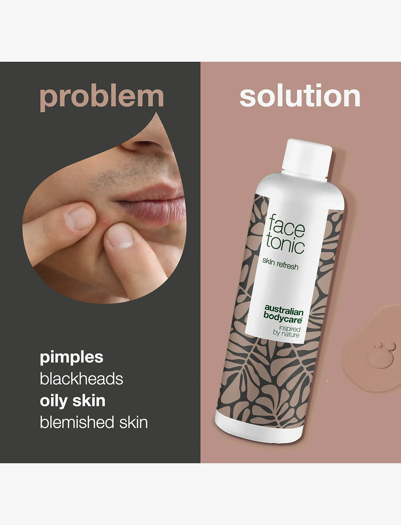 Australian Bodycare - Face Tonic - Toner for blemished skin - 150 ml - fugtgivende tonere - no color - 2