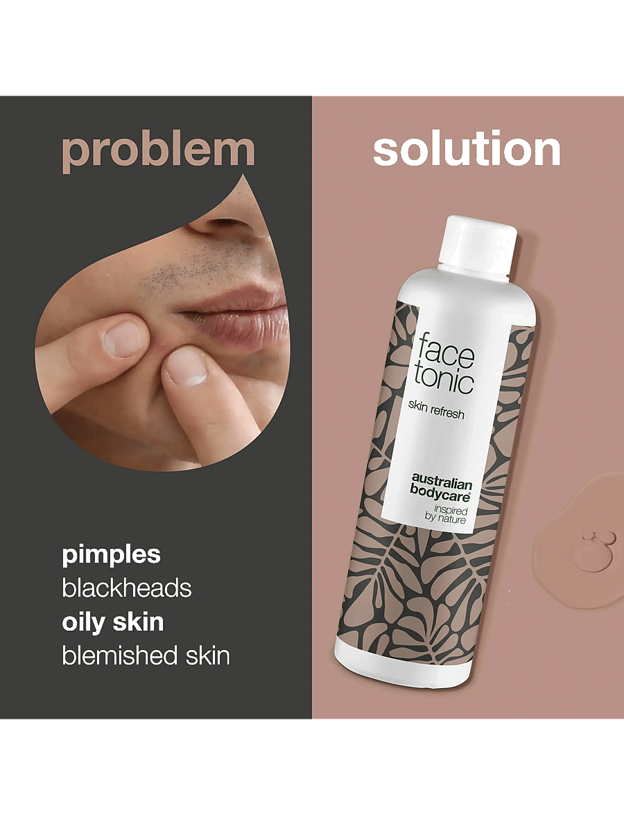 Australian Bodycare - Face Tonic - Toner for blemished skin - 150 ml - feuchtigkeitsspendende toner - no color - 2