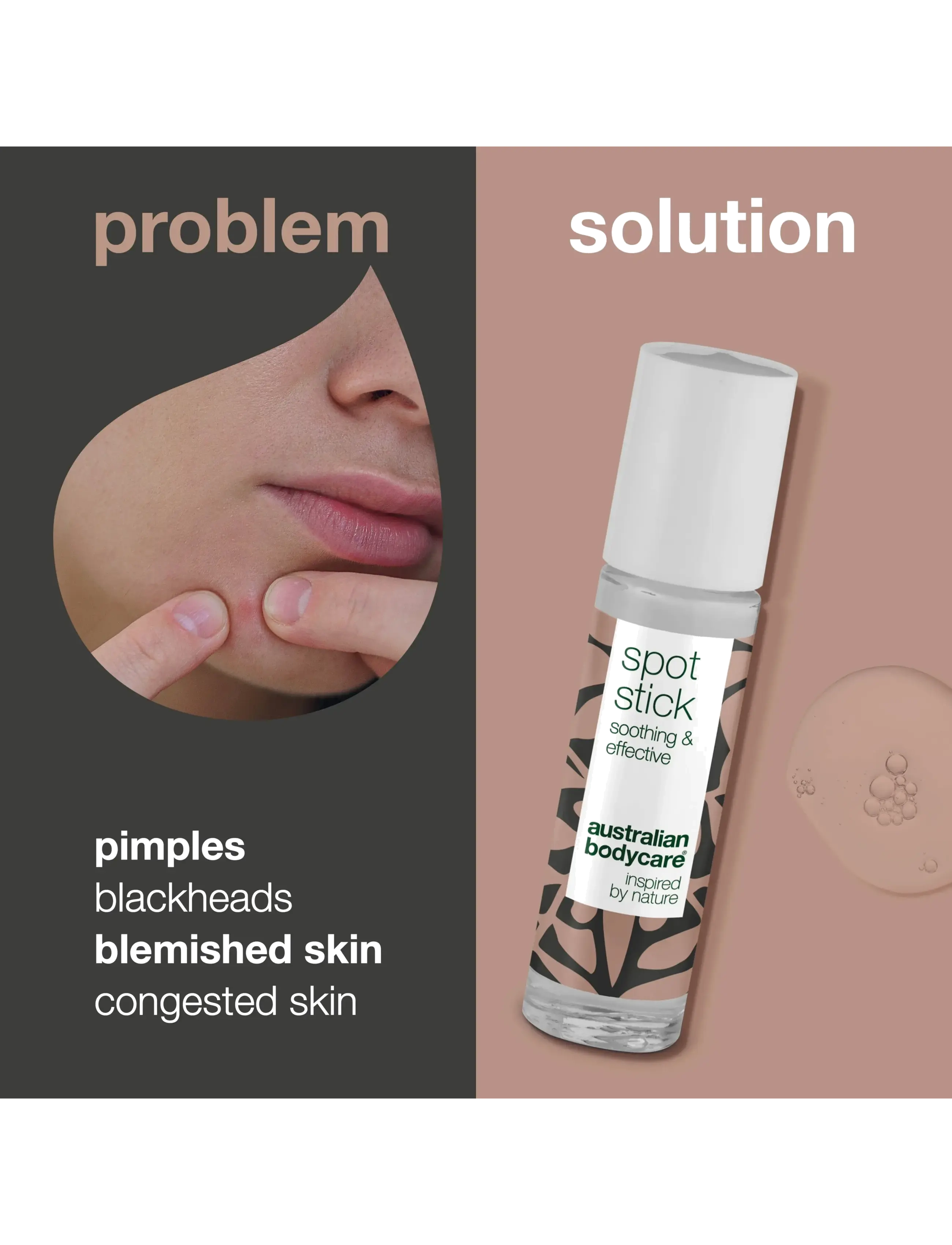 Australian Bodycare - Spot Stick for blemishes and pimples - 9 ml - spotbehandlinger - no color - 2