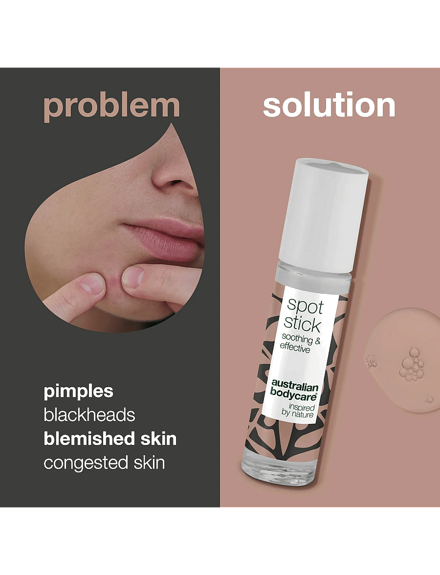 Australian Bodycare - Spot Stick for blemishes and pimples - 9 ml - spordihooldusvahendid - no color - 2
