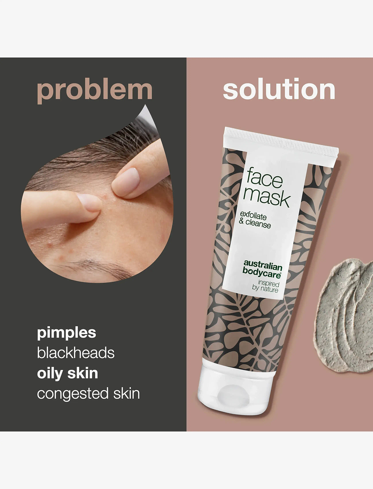 Australian Bodycare - Face Mask for pimples & blackheads - 100 ml - peeling masker - no color - 2
