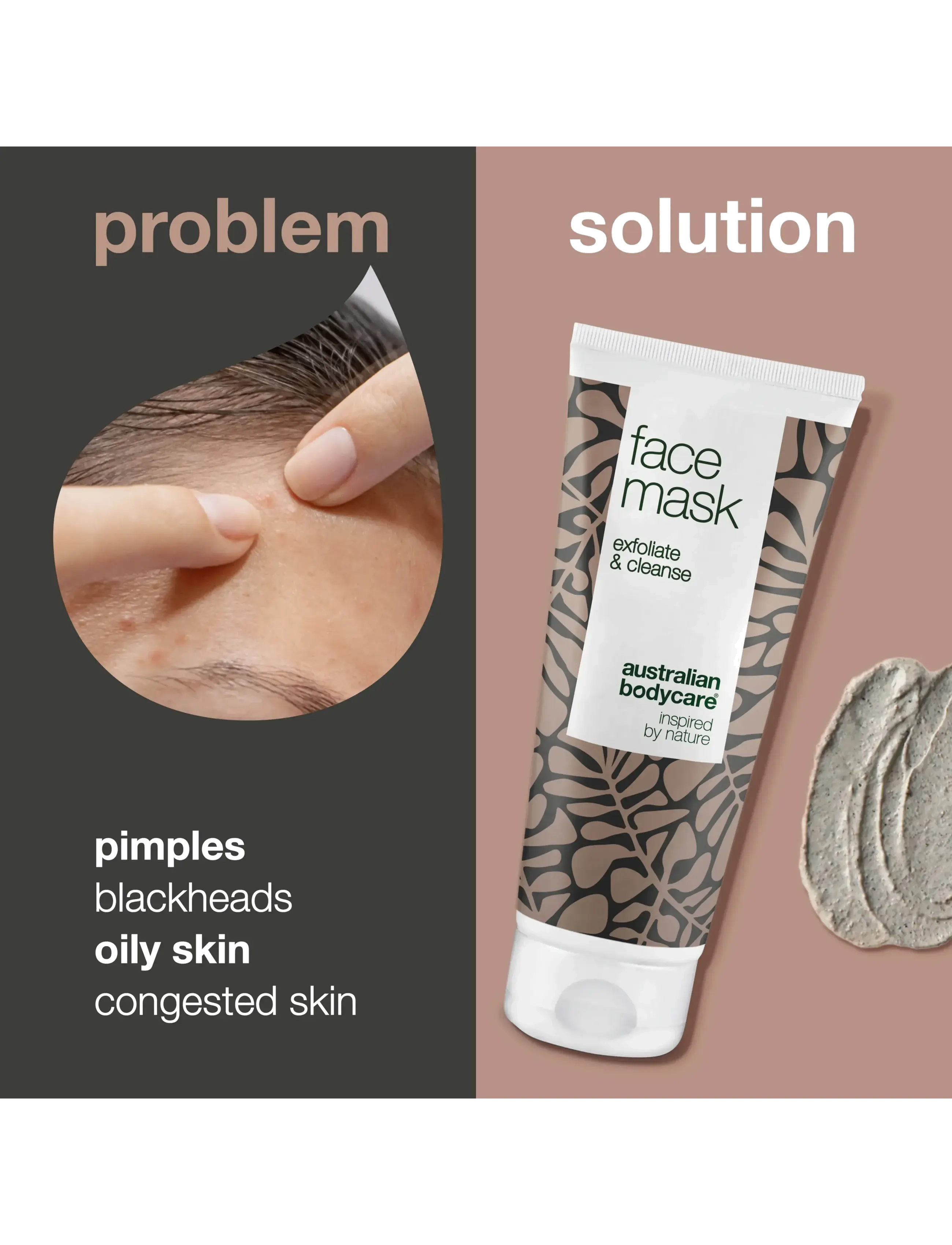 Australian Bodycare - Face Mask for pimples & blackheads - 100 ml - peeling masker - no color - 2