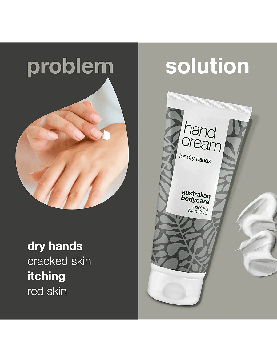 Australian Bodycare - Hand Cream for dry skin on hands - 100 ml - handcremes - no color - 2