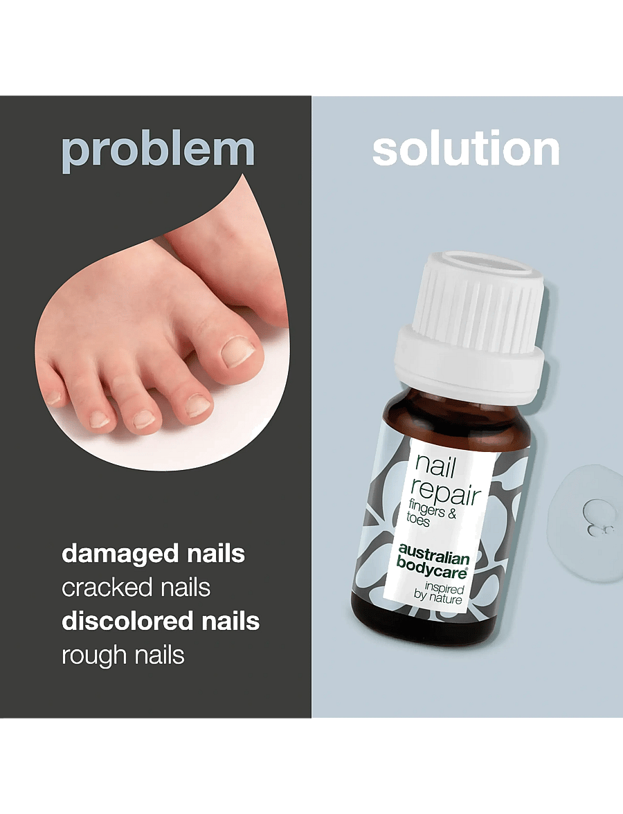 Australian Bodycare - Nail Repair 10 ml - klár fyrir stefnumótið - clear - 1