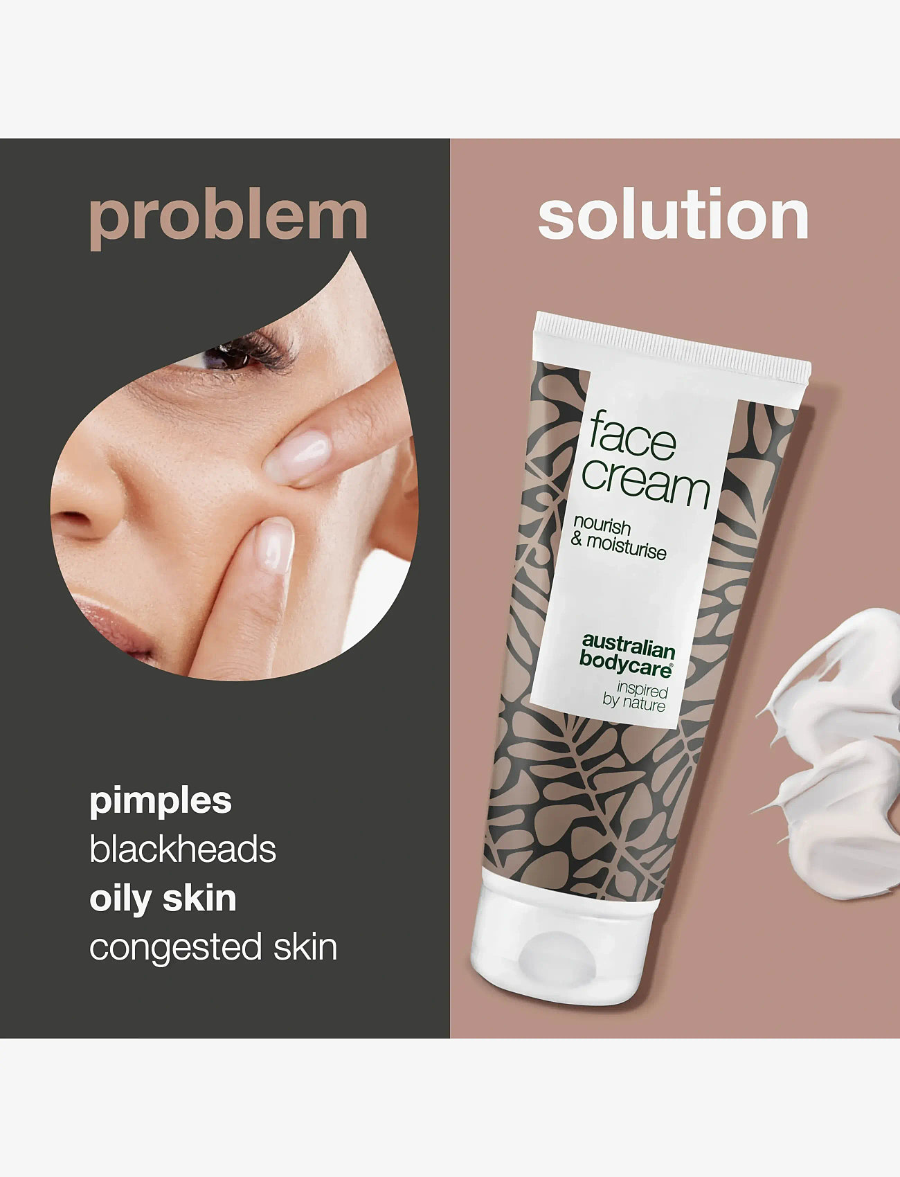 Australian Bodycare - Face Cream for pimples or dry skins - 100 ml - fuktkrämer - no color - 2