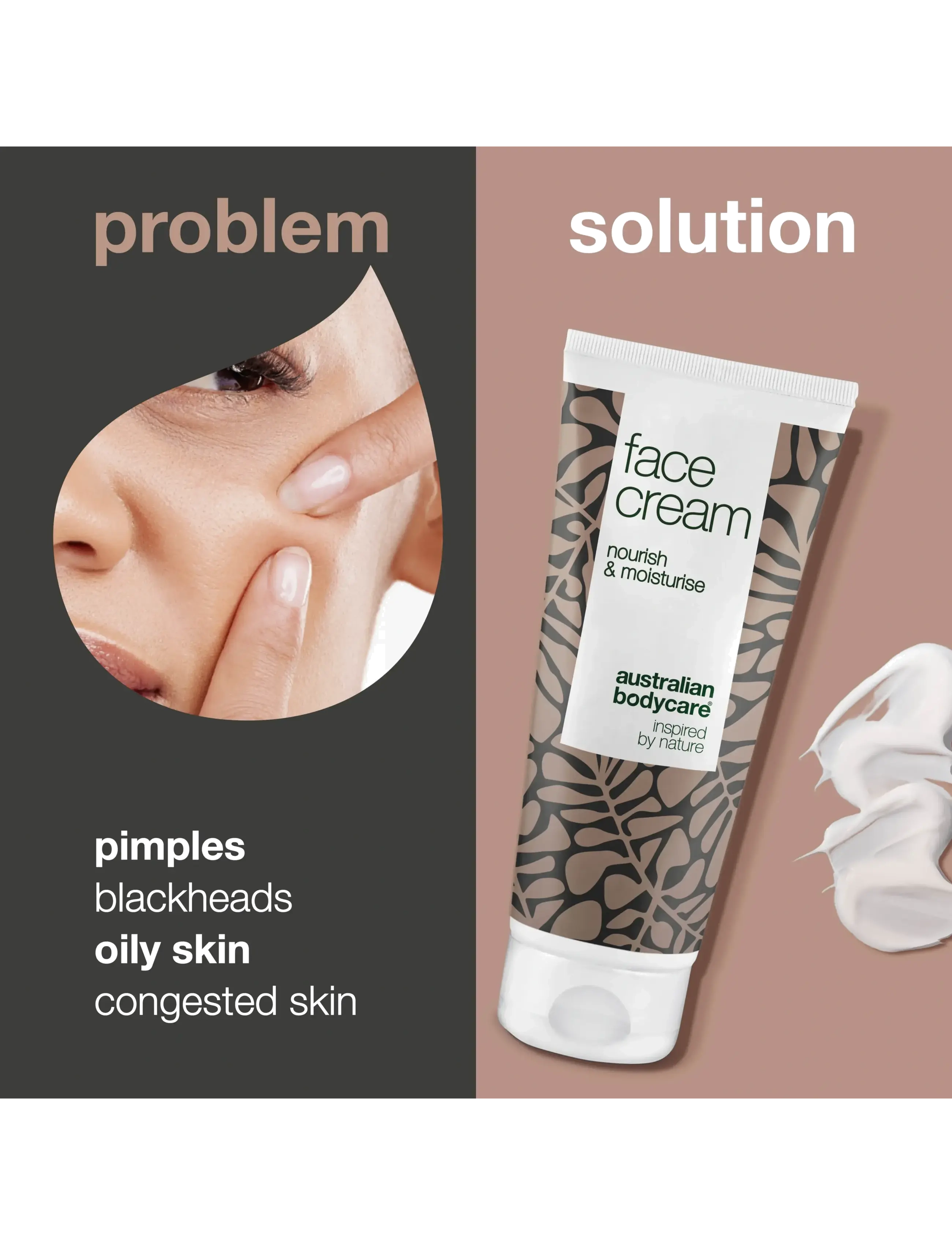 Australian Bodycare - Face Cream for pimples or dry skins - 100 ml - fugtpleje - no color - 2