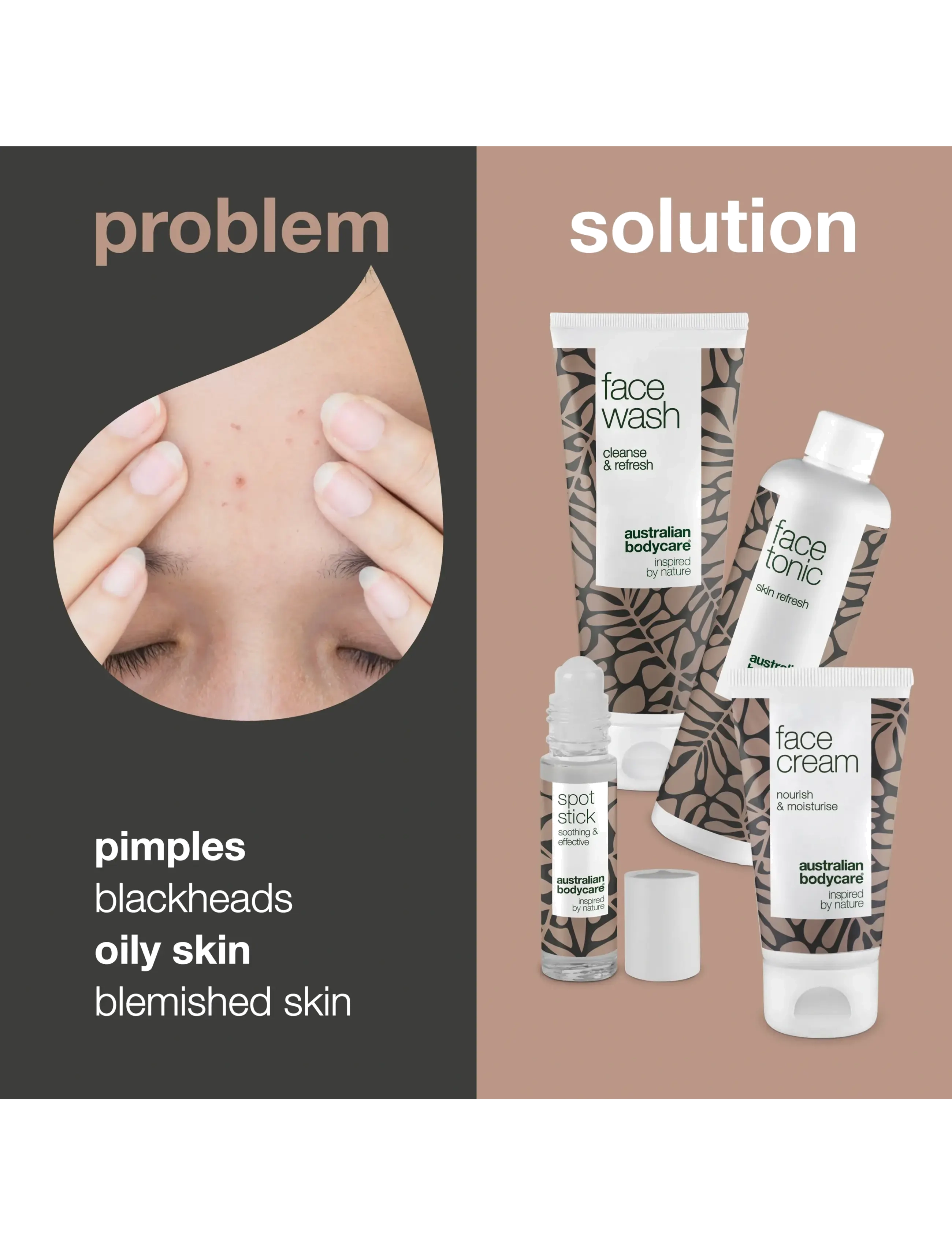 Australian Bodycare - 4 Step Face Care - complete kit for blemishes & pimples - 4 pcs - mellem 200-500 kr - no color - 2