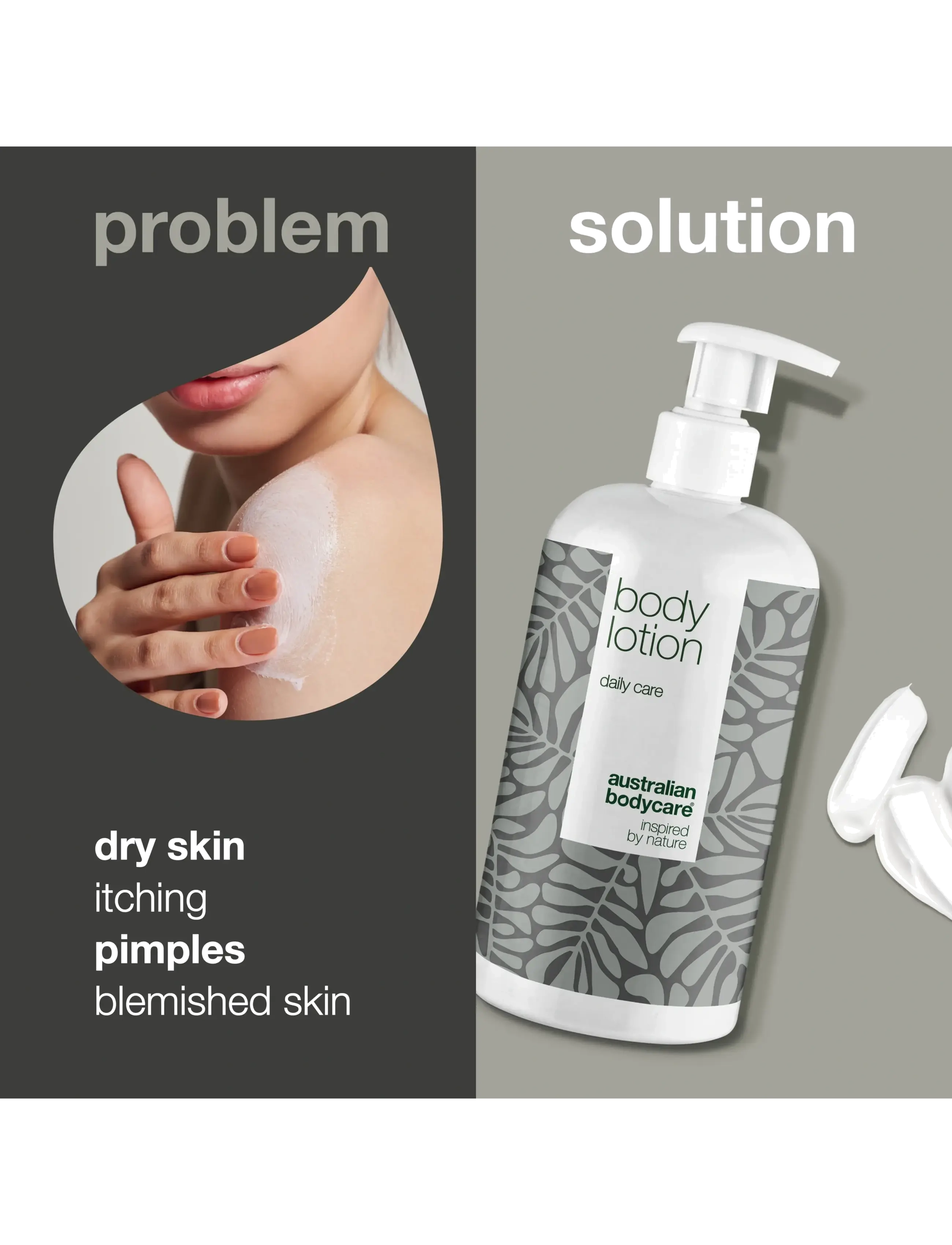 Australian Bodycare - Body Lotion for dry skin & pimples - 500 ml - lotion & creme - no color - 2