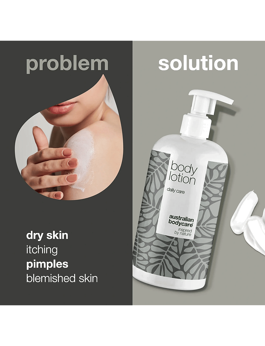 Australian Bodycare - Body Lotion for dry skin & pimples - 500 ml - lotion & creams - no color - 2