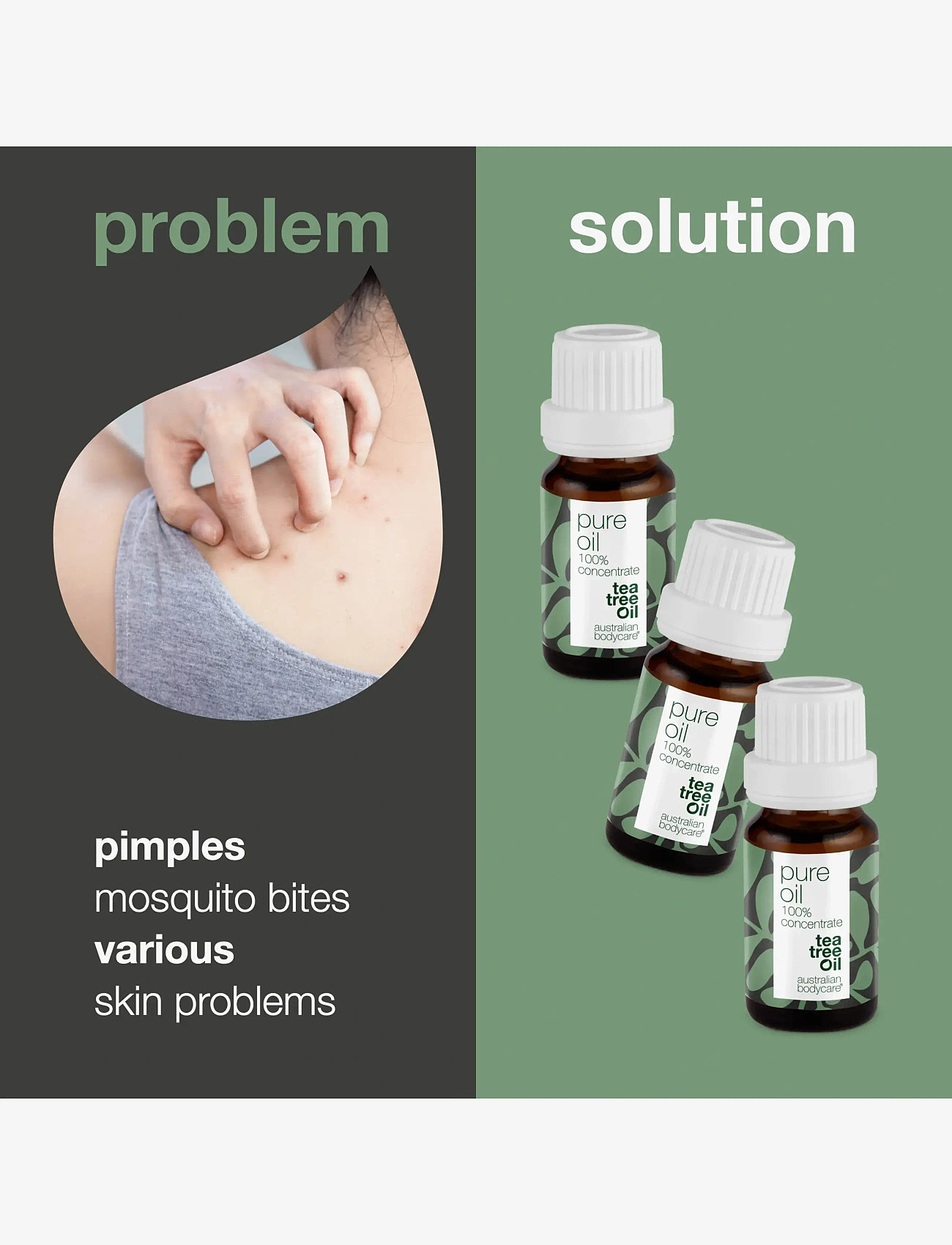 Australian Bodycare - 3x Tea Tree Oil – 100% concentrate - punktbehandlare - no color - 2