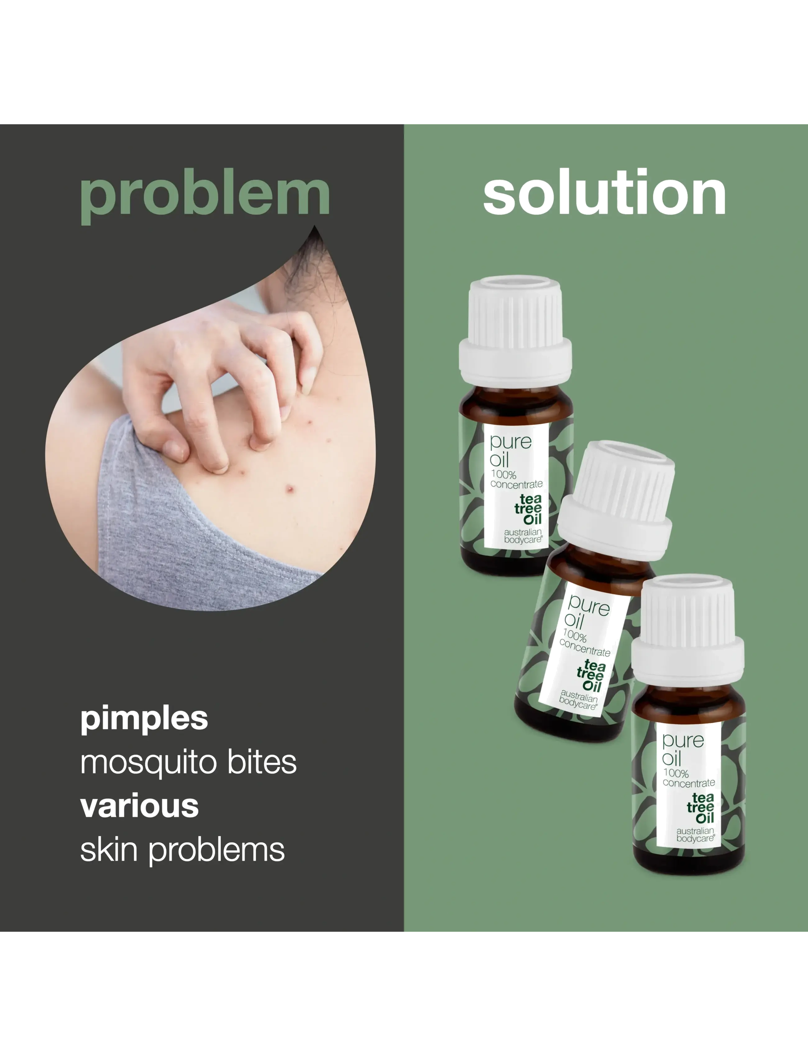 Australian Bodycare - 3x Tea Tree Oil – 100% concentrate - täsmähoito - no color - 2