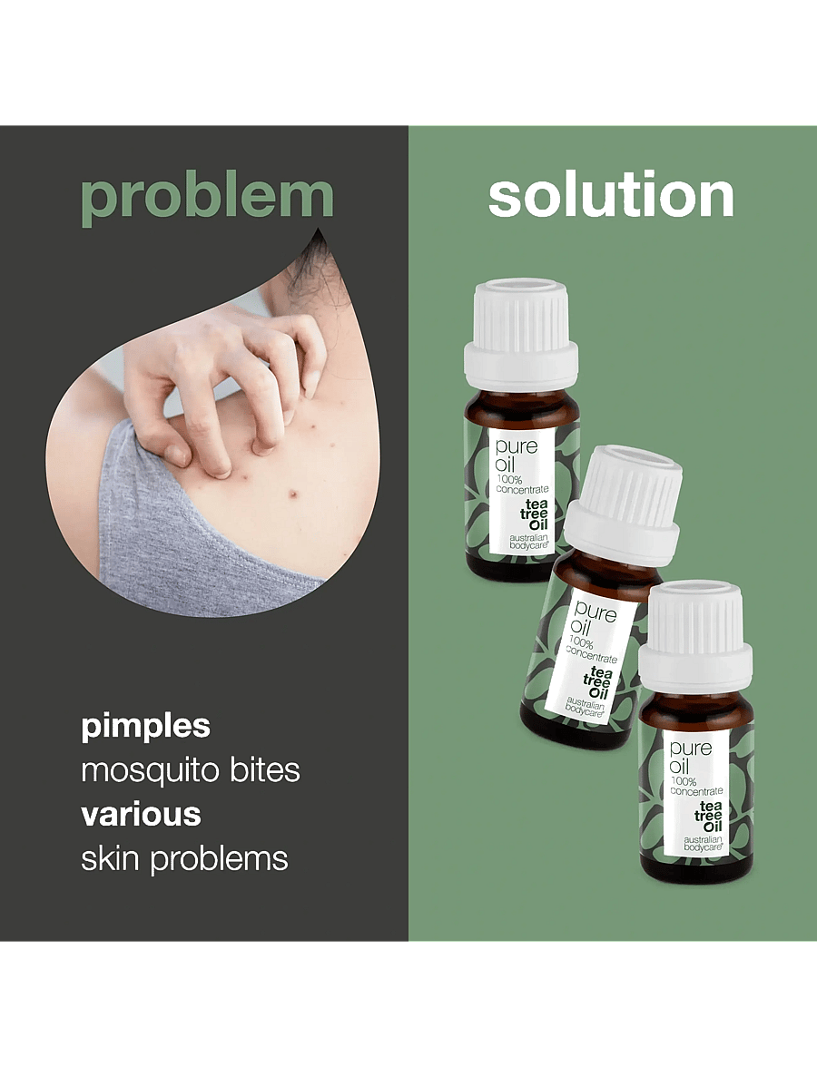 Australian Bodycare - 3x Tea Tree Oil – 100% concentrate - täsmähoito - no color - 2
