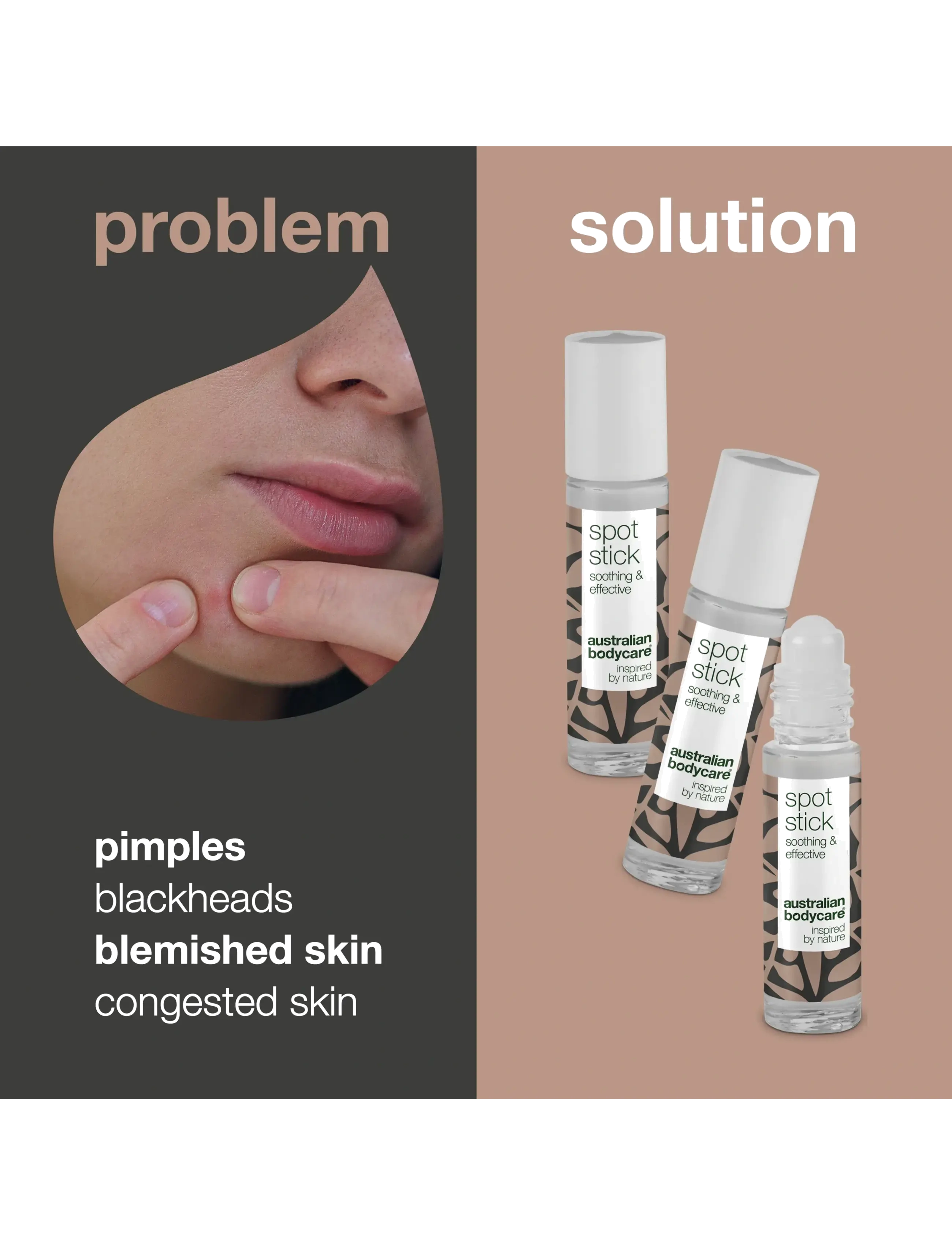 Australian Bodycare - 3-pack Spot Stick for pimples - spotbehandlinger - no color - 2