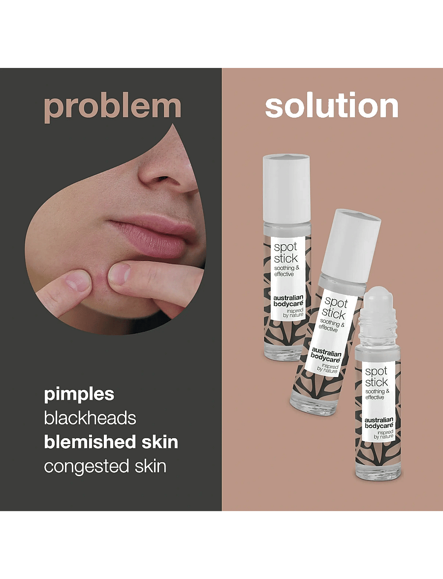 Australian Bodycare - 3-pack Spot Stick for pimples - no color - 2