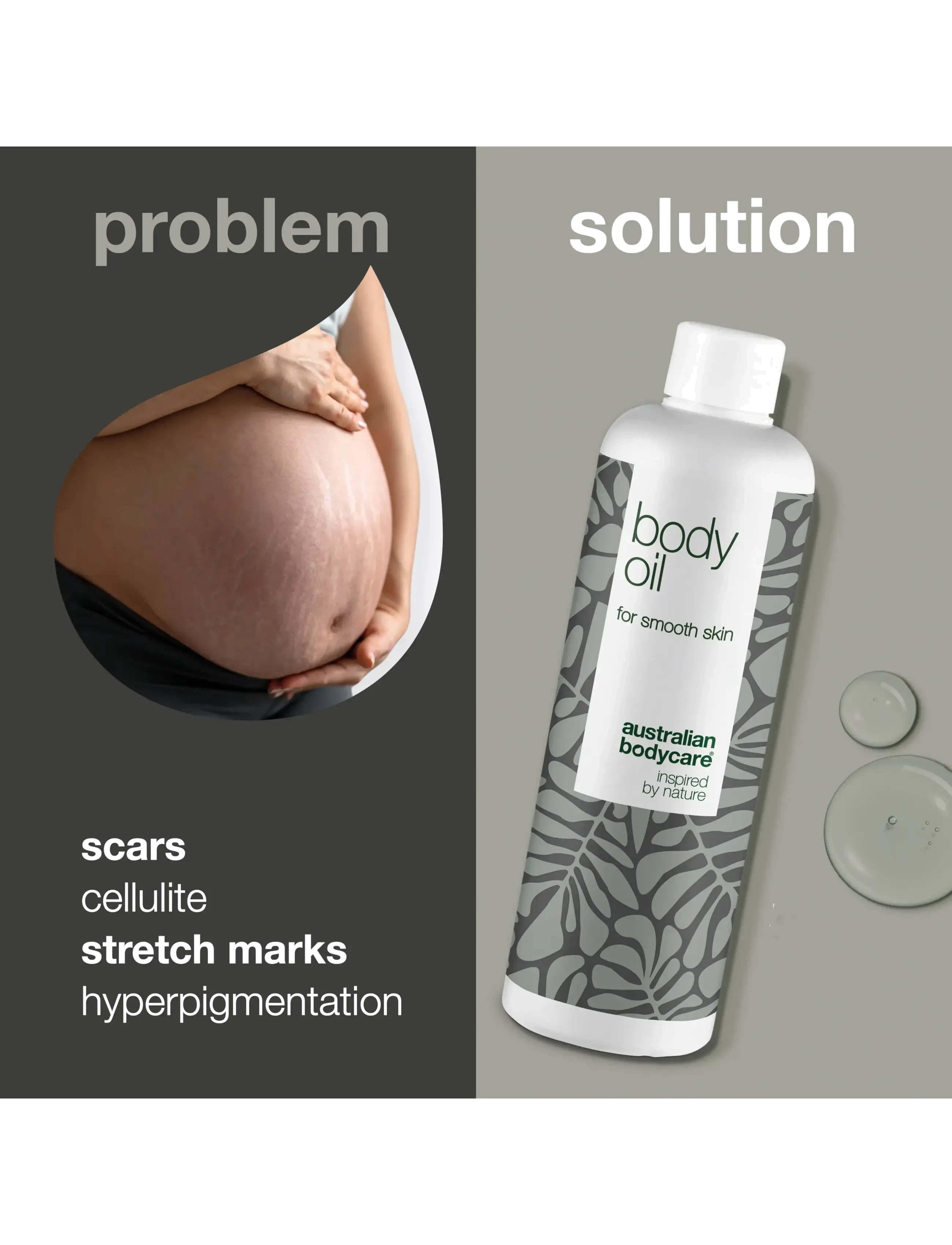 Australian Bodycare - Body Oil to improve the appearance of stretch marks and scars - 150 ml - kropsolier - no color - 2