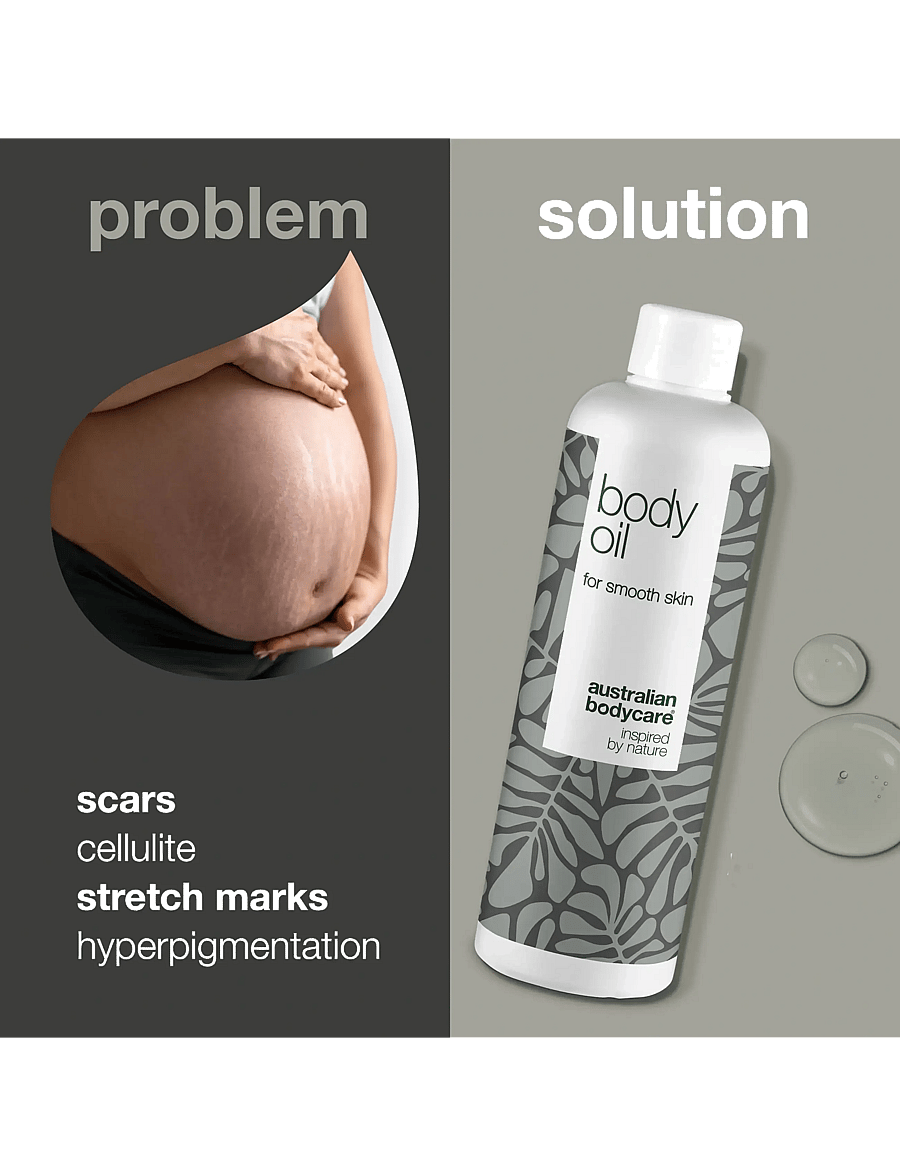 Australian Bodycare - Body Oil to improve the appearance of stretch marks and scars - 150 ml - kehaõlid - no color - 2