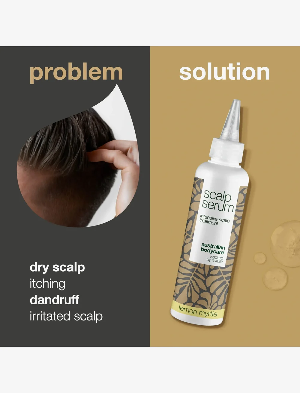 Australian Bodycare - Scalp Serum Intensive scalp treatment - Lemon Myrtle - 150ml - juuksehooldused - no color - 2