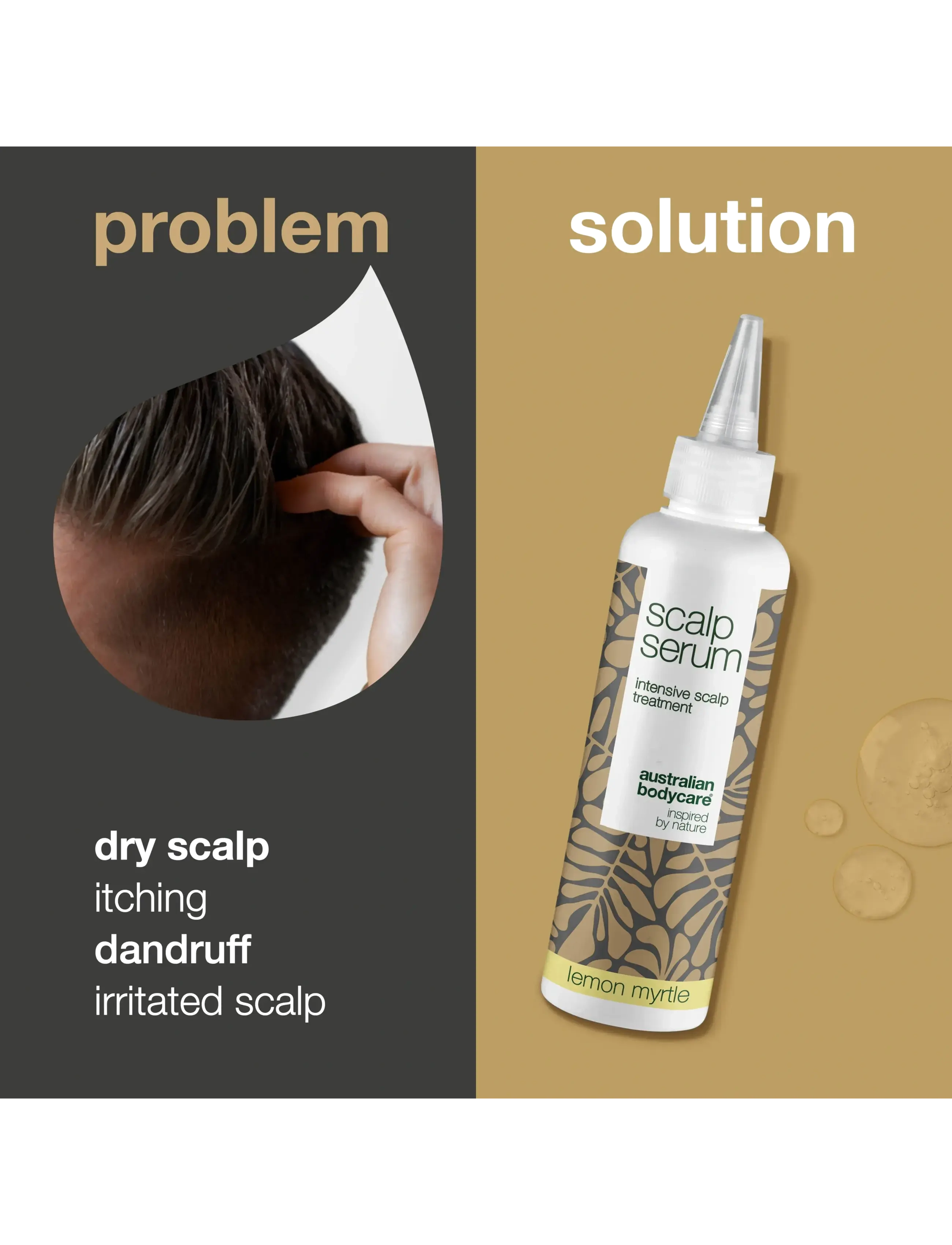 Australian Bodycare - Scalp Serum Intensive scalp treatment - Lemon Myrtle - 150ml - hårkur - no color - 2