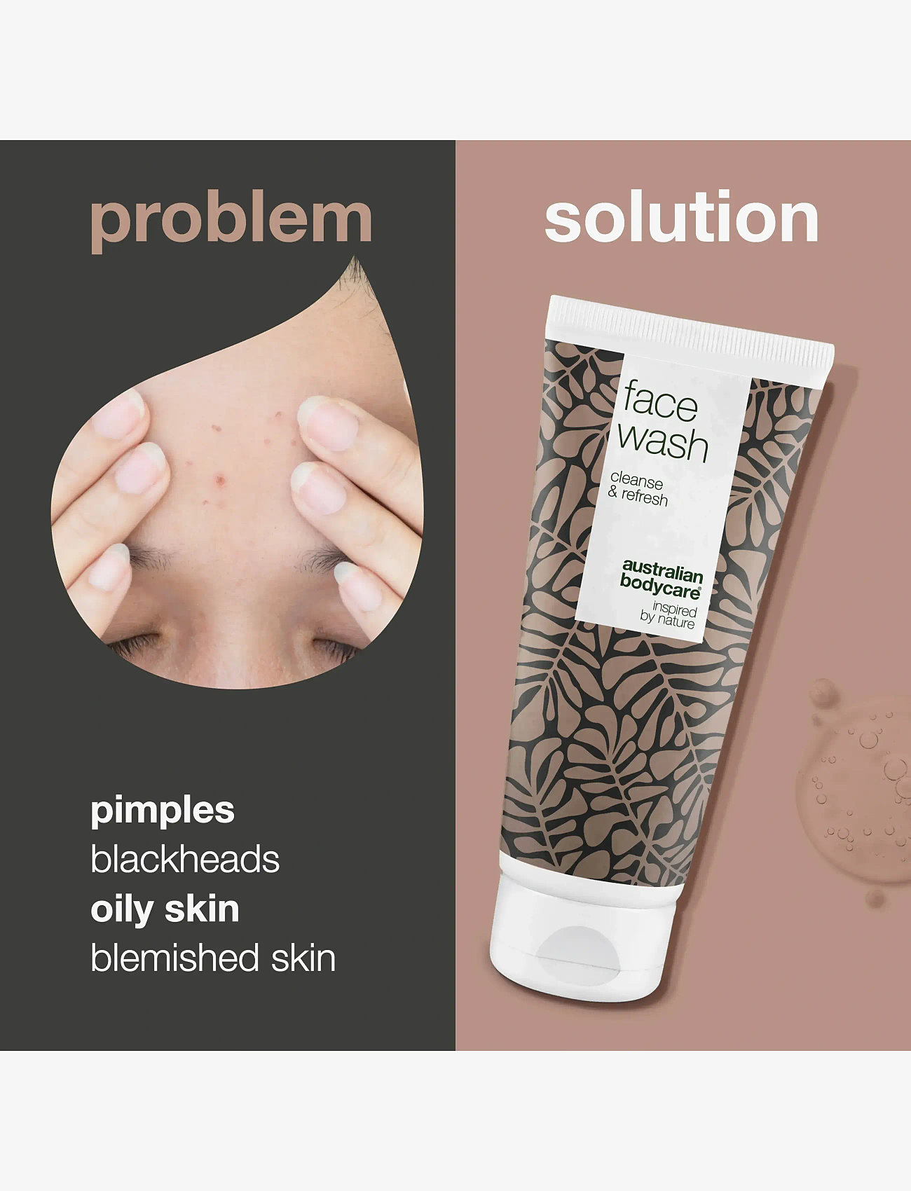 Australian Bodycare - Face Wash for blemishes and pimples - 200 ml - rengöringsgel - no color - 2