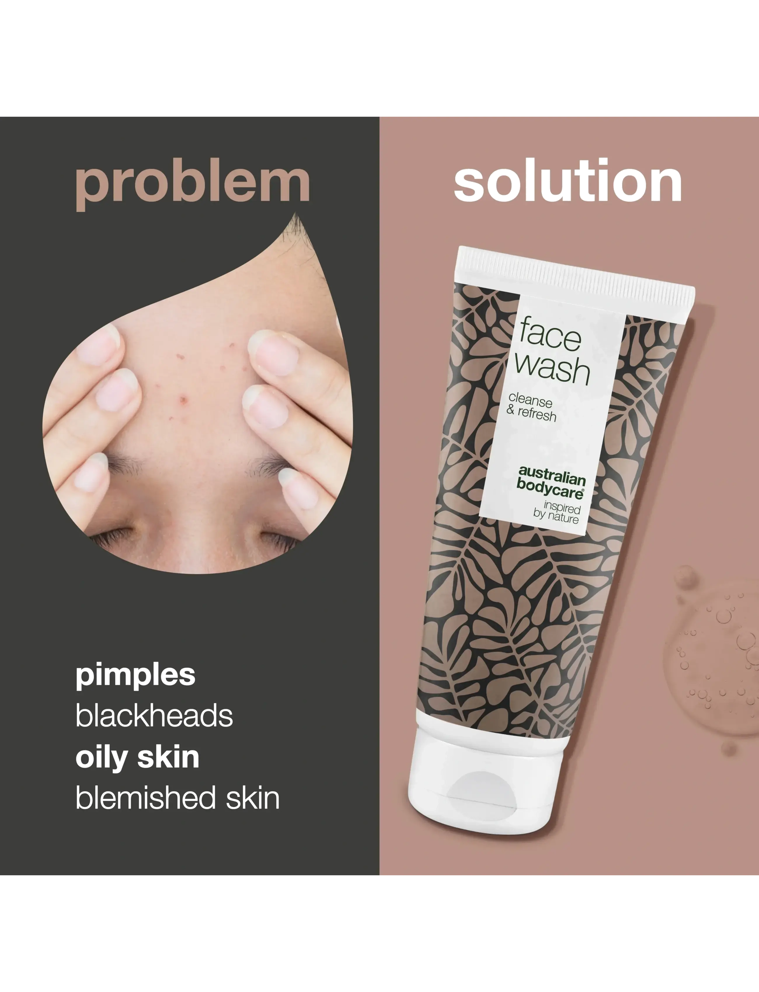 Australian Bodycare - Face Wash for blemishes and pimples - 200 ml - rensegels - no color - 2