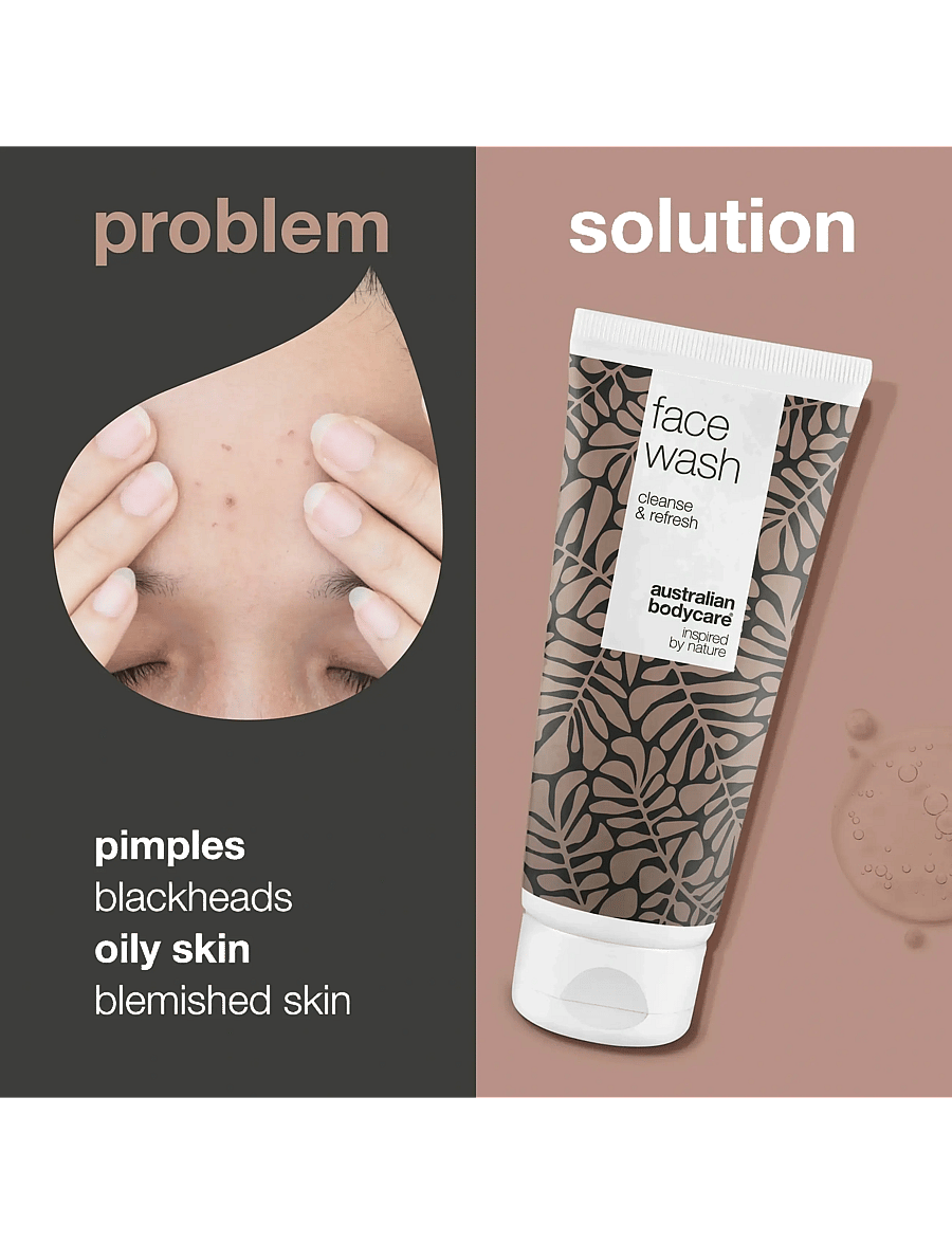 Australian Bodycare - Face Wash for blemishes and pimples - 200 ml - näopesu - no color - 2