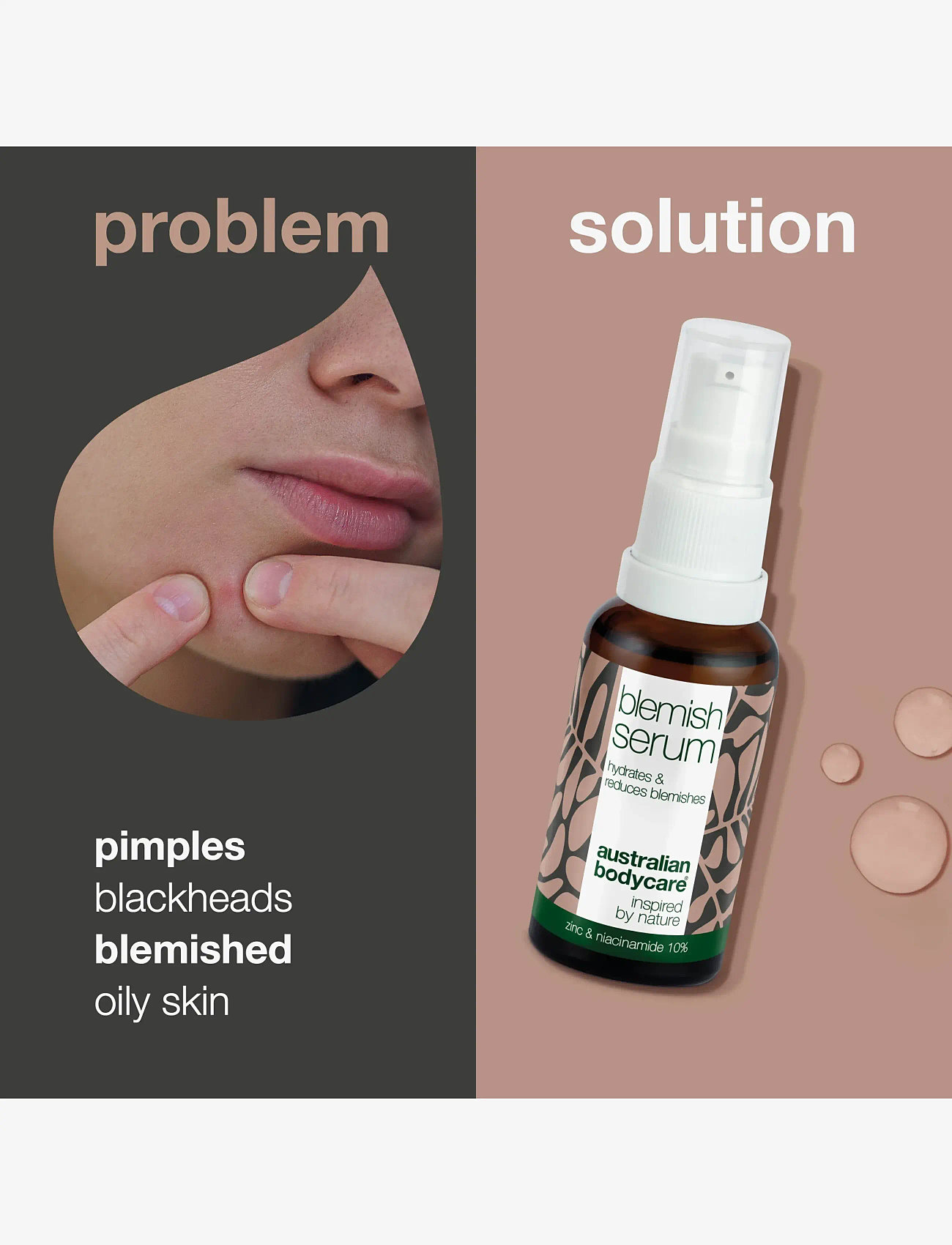 Australian Bodycare - Blemish Serum with Niacinamide 10% - 30 ml - serum - no color - 2