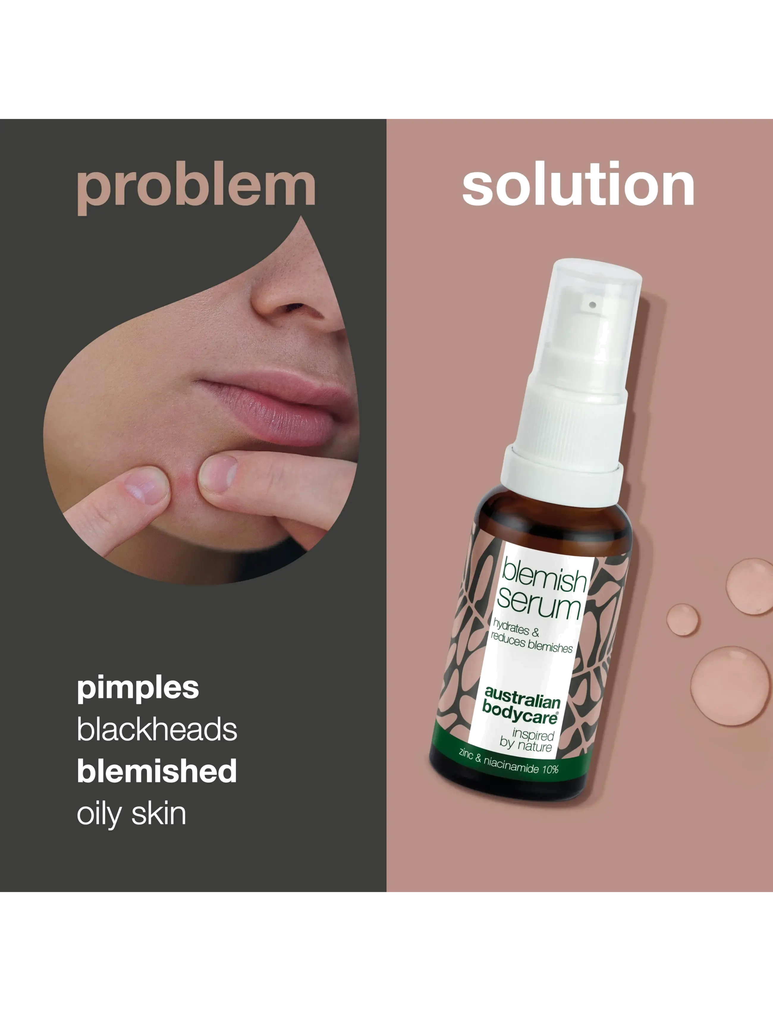 Australian Bodycare - Blemish Serum with Niacinamide 10% - 30 ml - serum - no color - 2