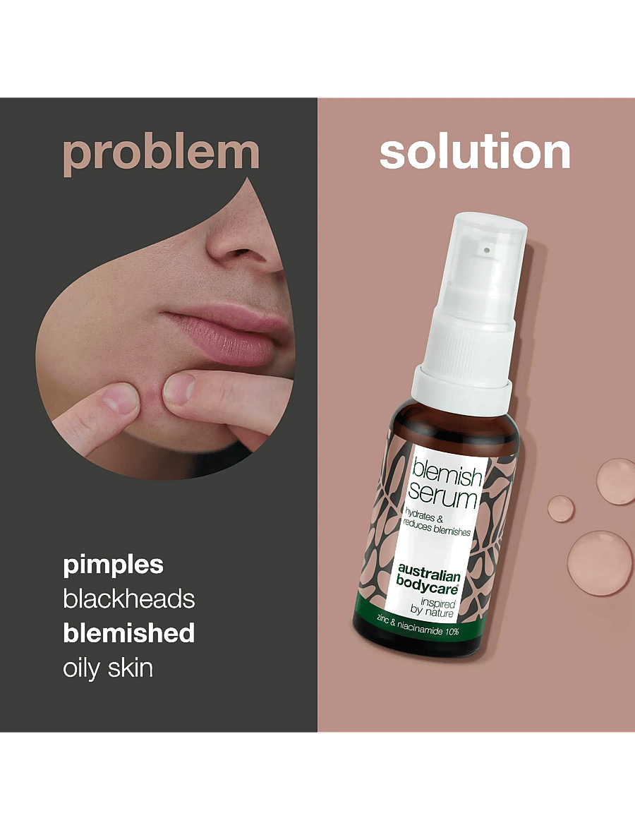 Australian Bodycare - Blemish Serum with Niacinamide 10% - 30 ml - no color - 2